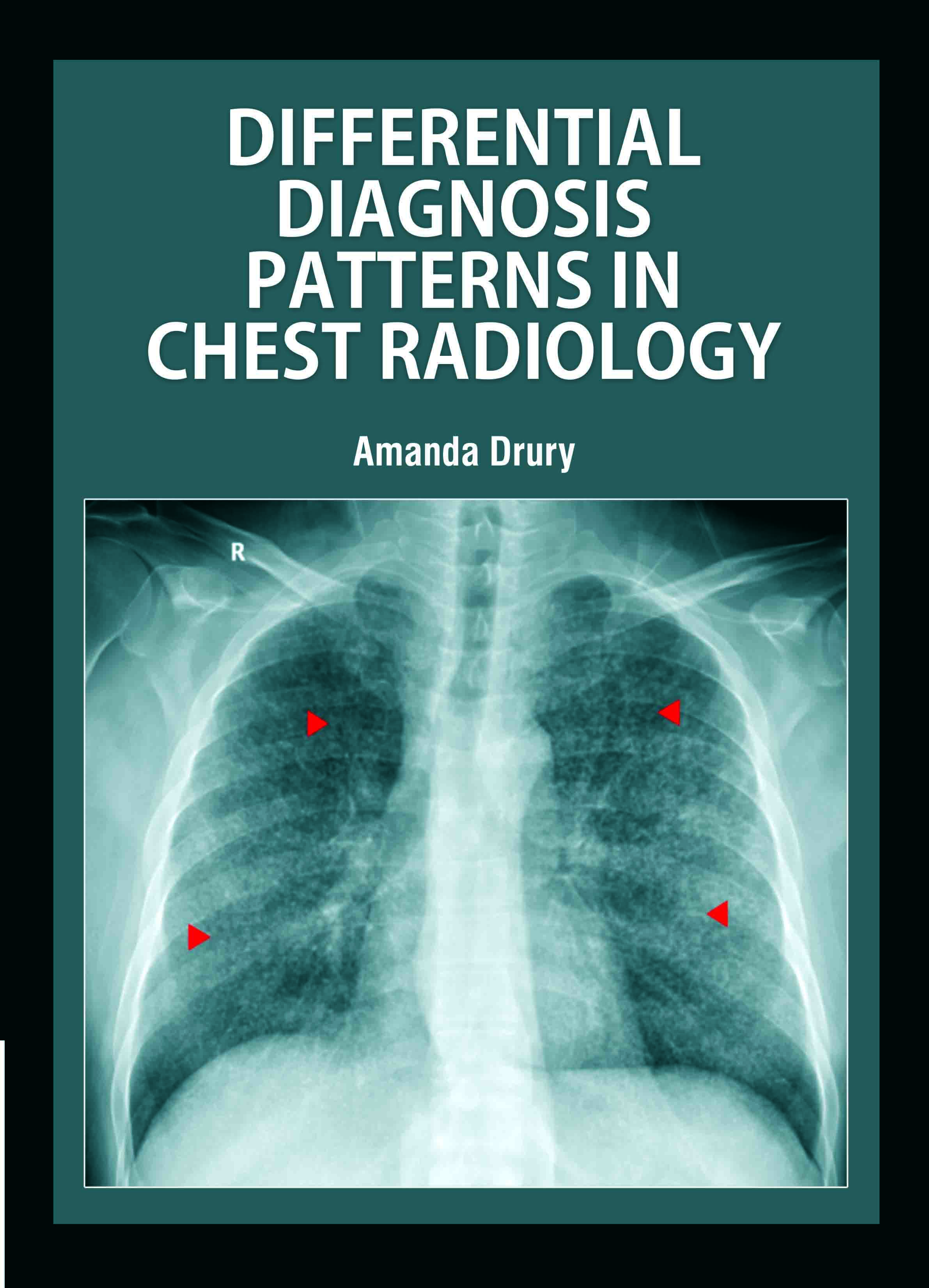 Differential Diagnosis Patterns in Chest Radiology