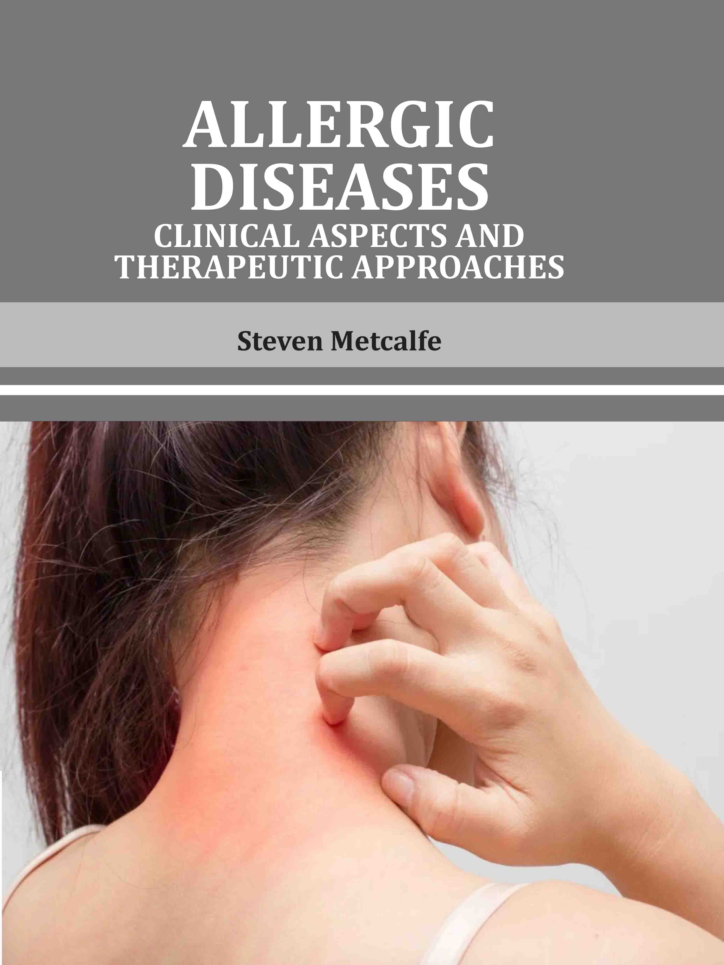Allergic Diseases: Clinical Aspects and Therapeutic Approaches