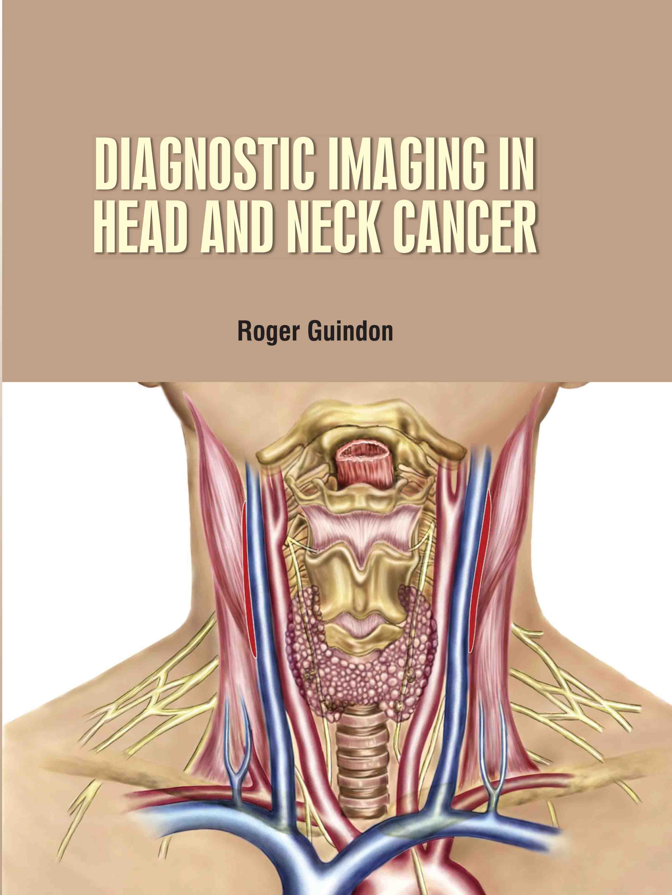 Diagnostic Imaging in Head and Neck Cancer