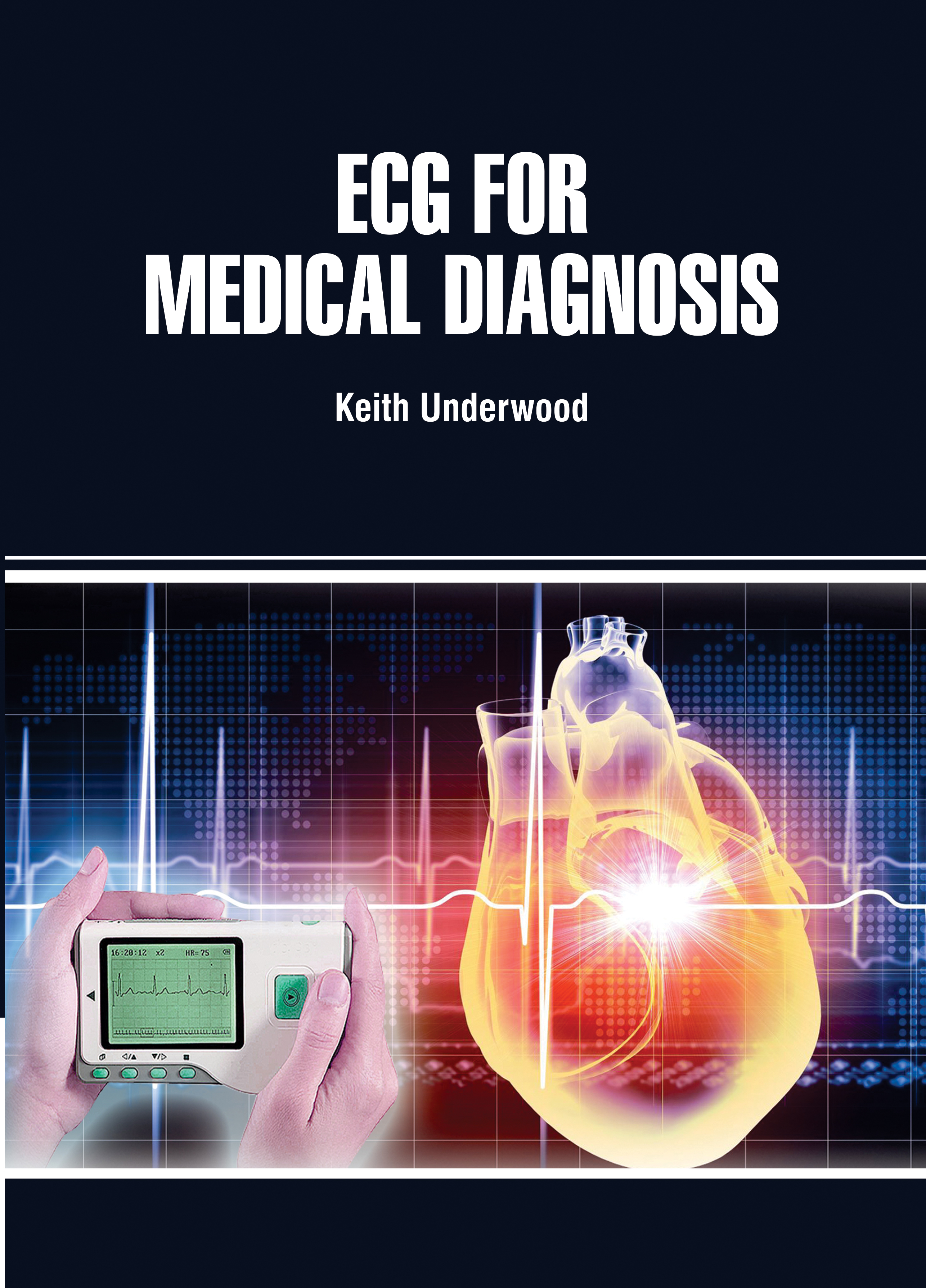 Ecg for Medical Diagnosis