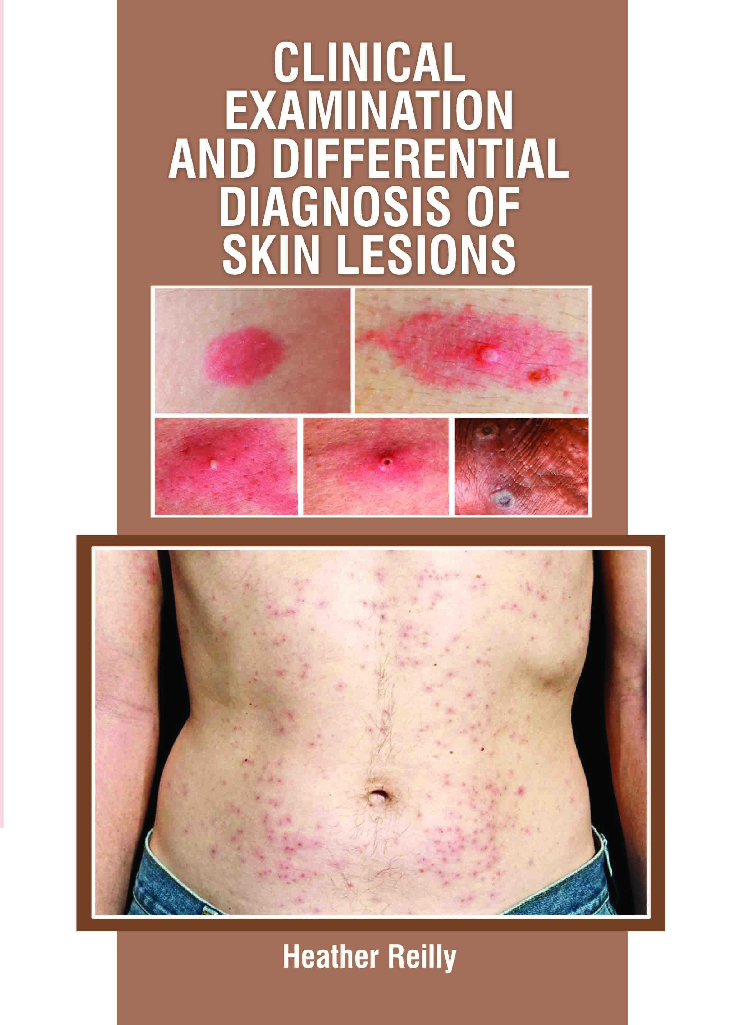 Clinical Examination and Differential Diagnosis of Skin Lesions