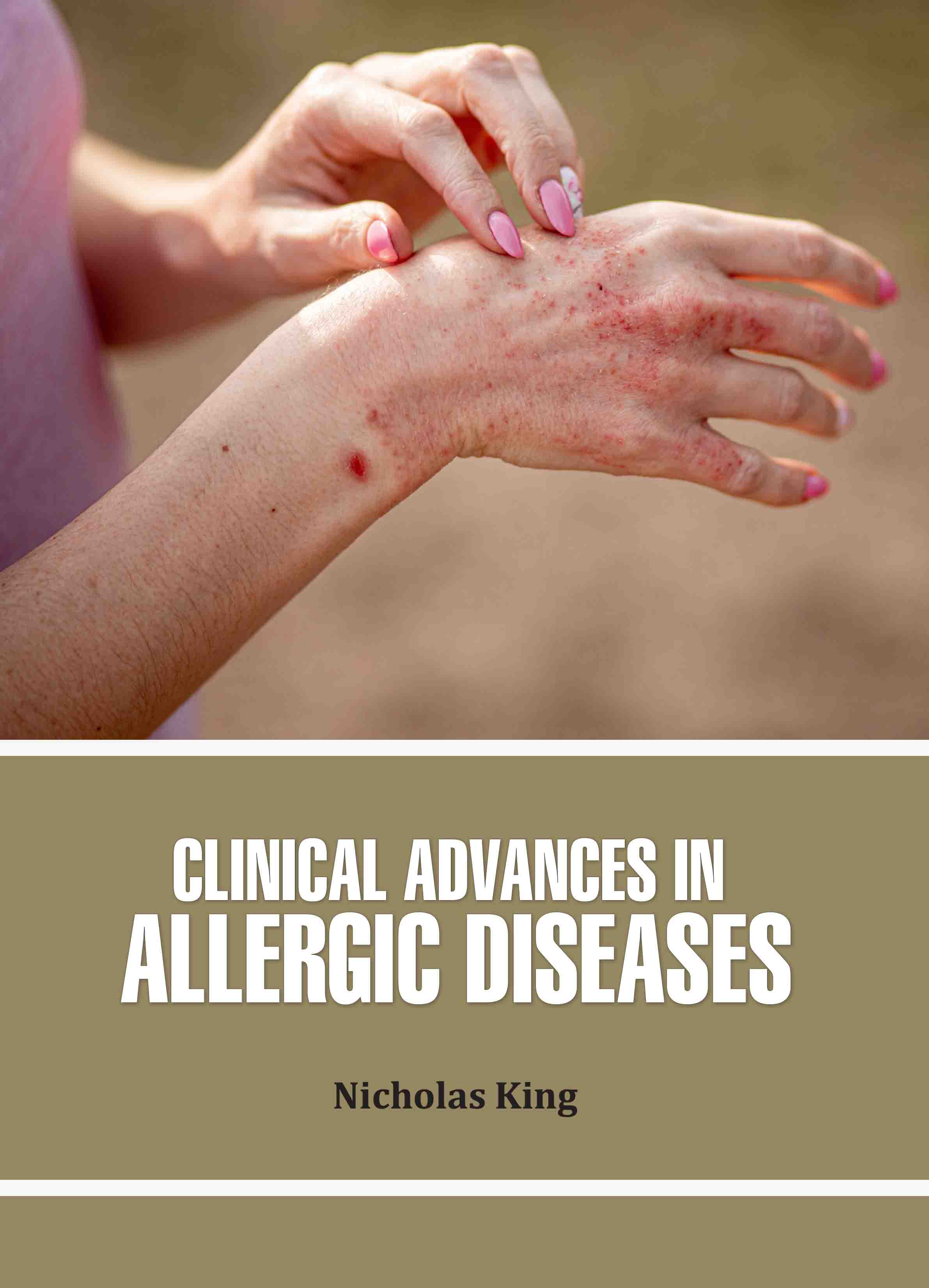 Clinical Advances in Allergic Diseases