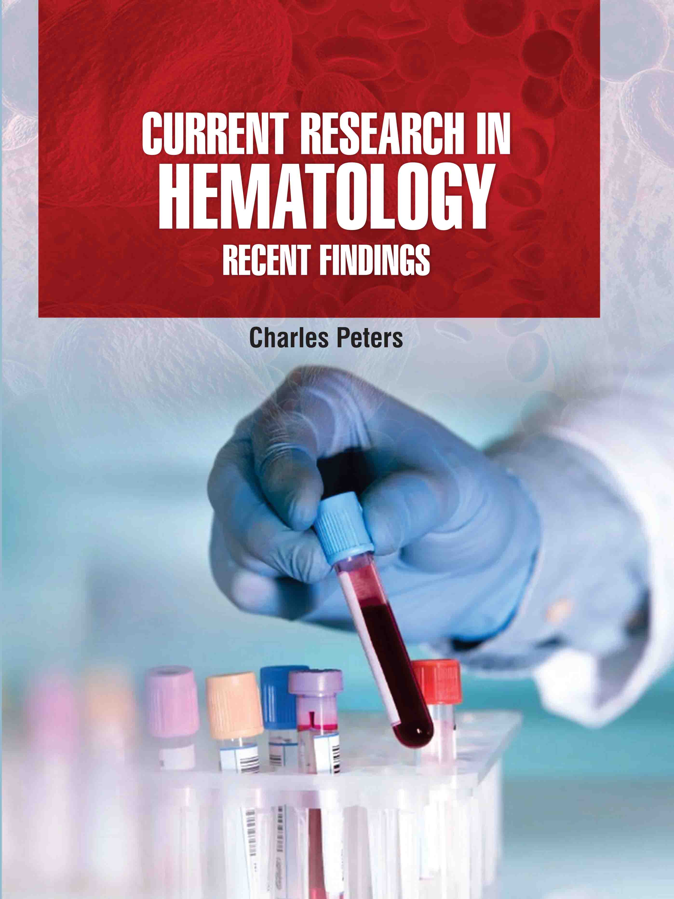 Current Research in Hematology: Recent Findings