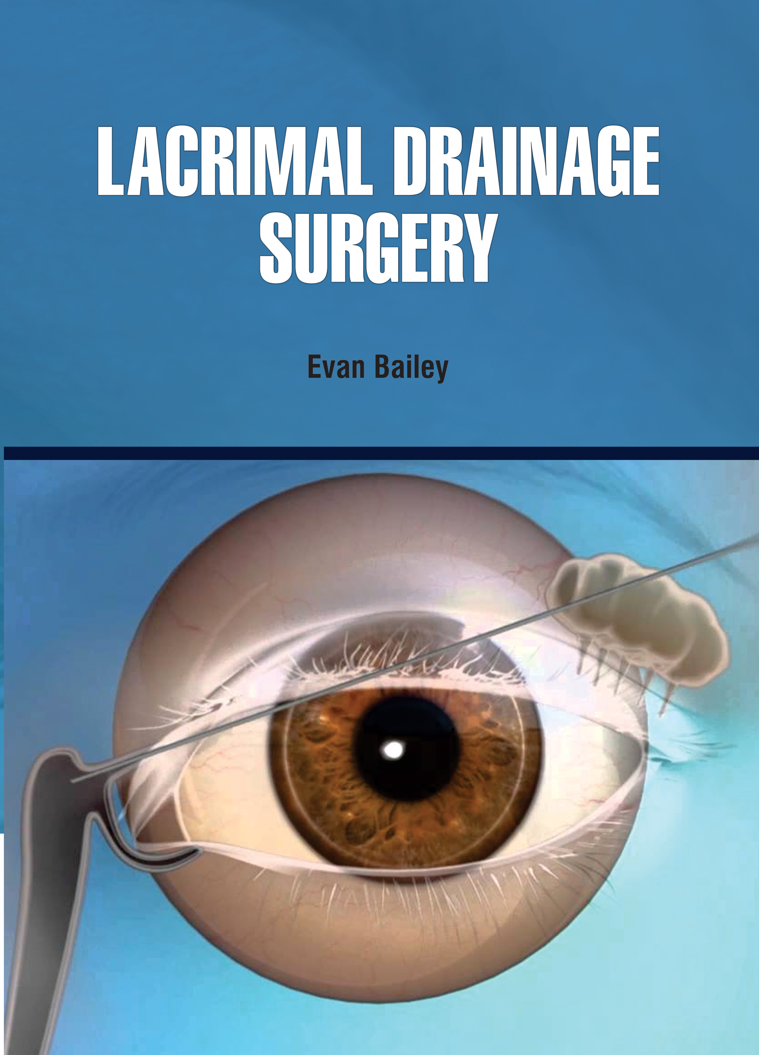 Lacrimal Drainage Surgery