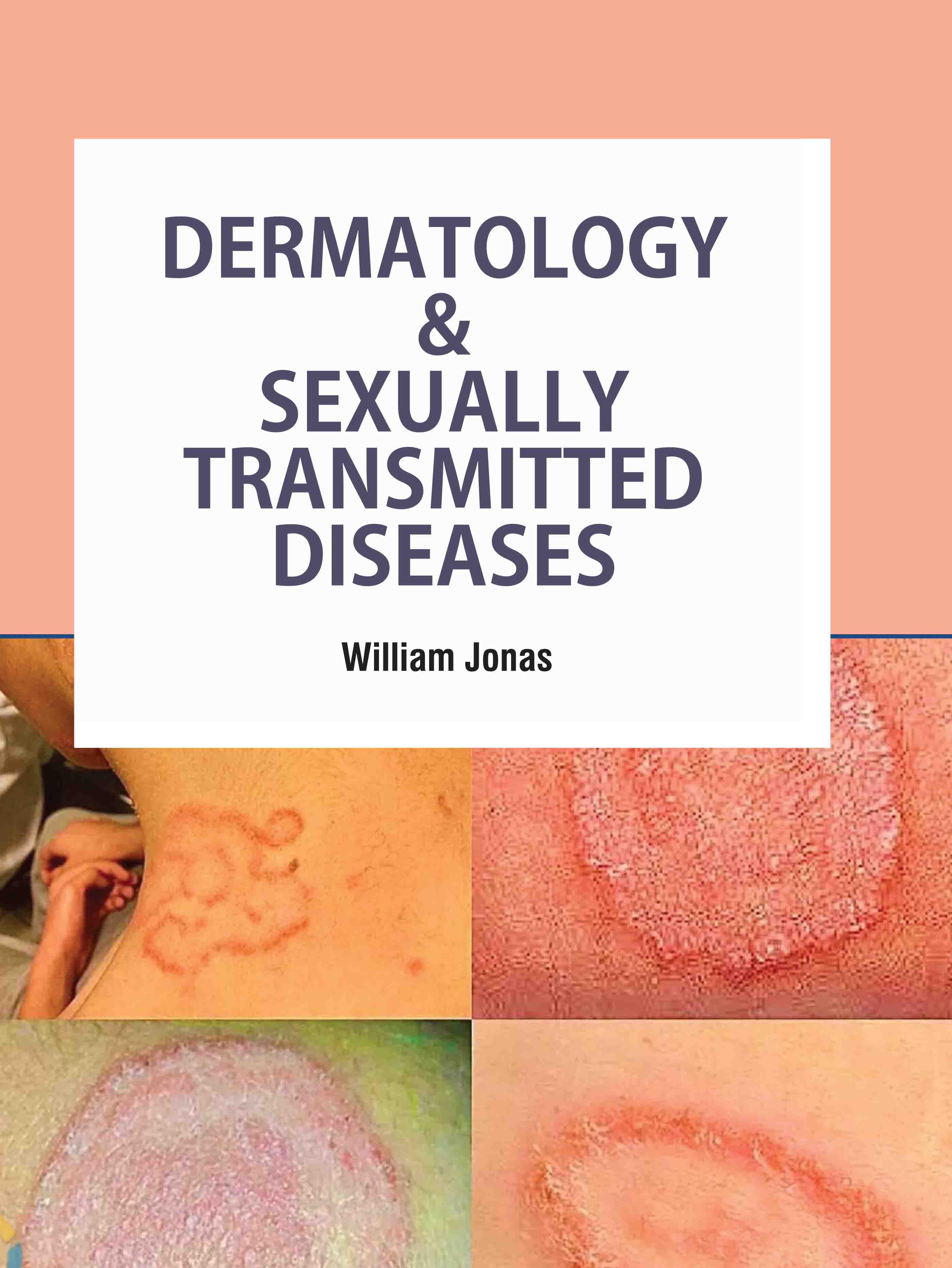 Dermatology & Sexually Transmitted Diseases