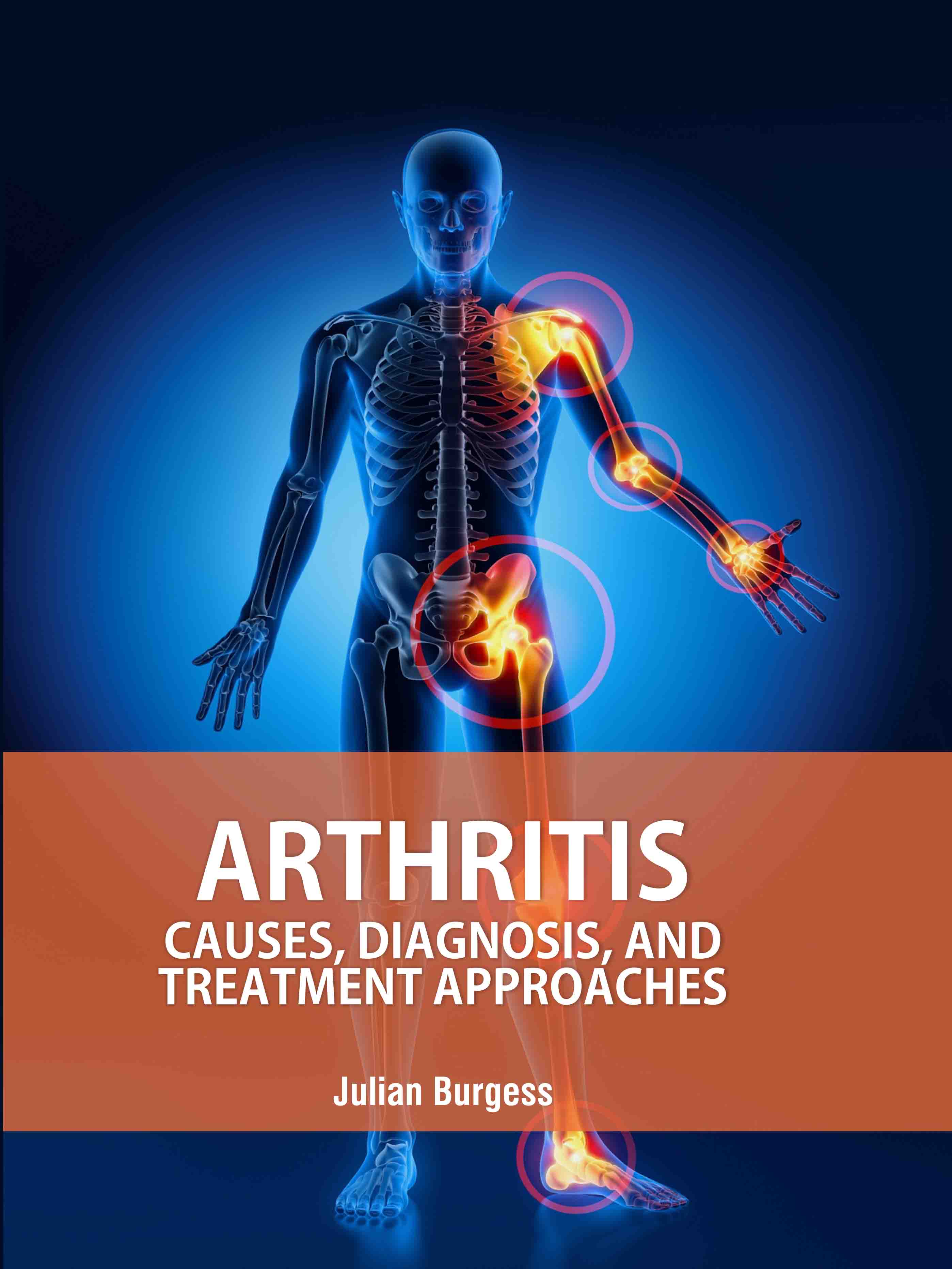 Arthritis: Causes, Diagnosis, and Treatment Approaches