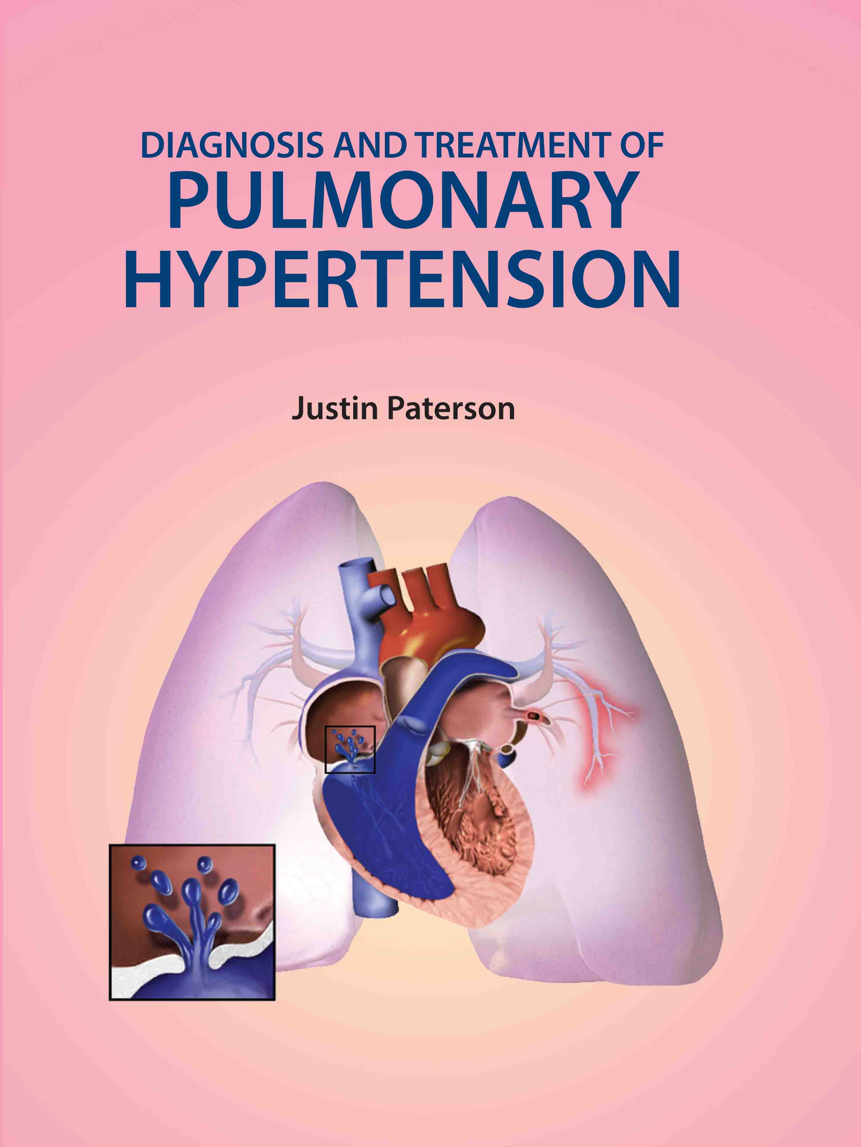 Diagnosis and Treatment of Pulmonary Hypertension