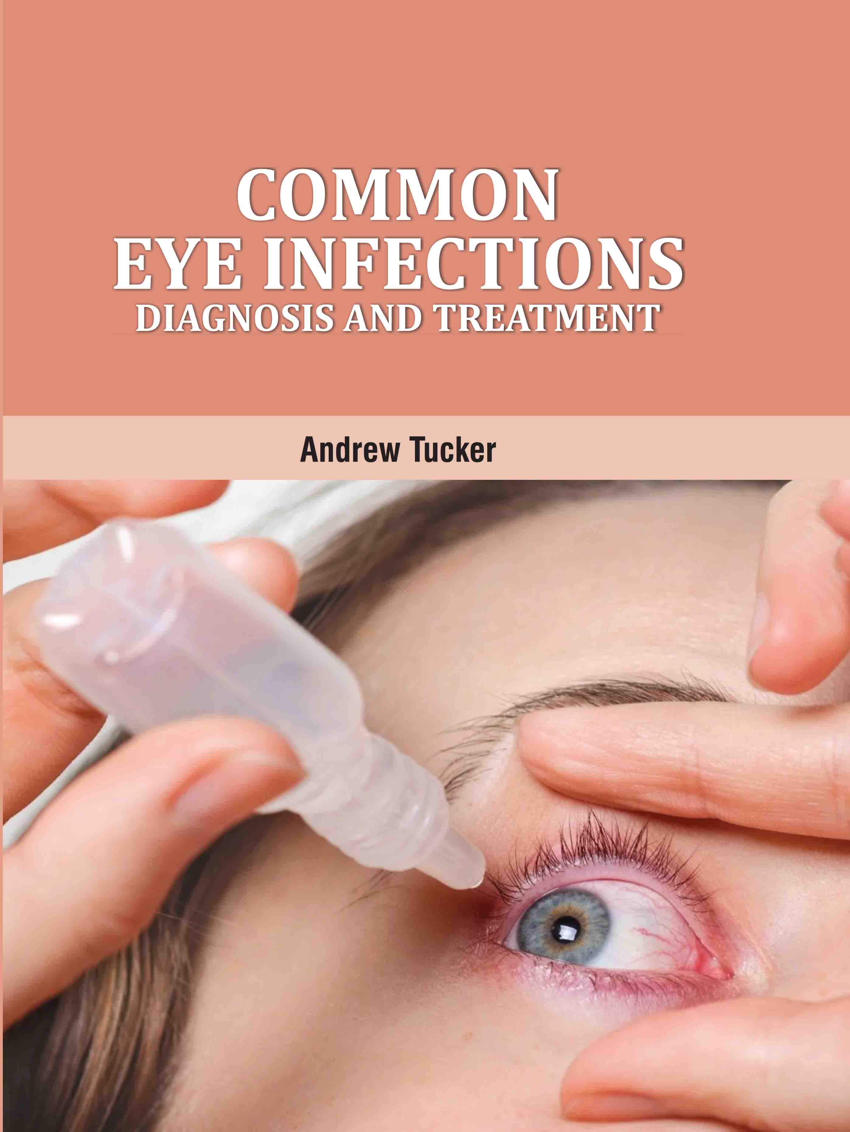 Common Eye Infections: Diagnosis and Treatment
