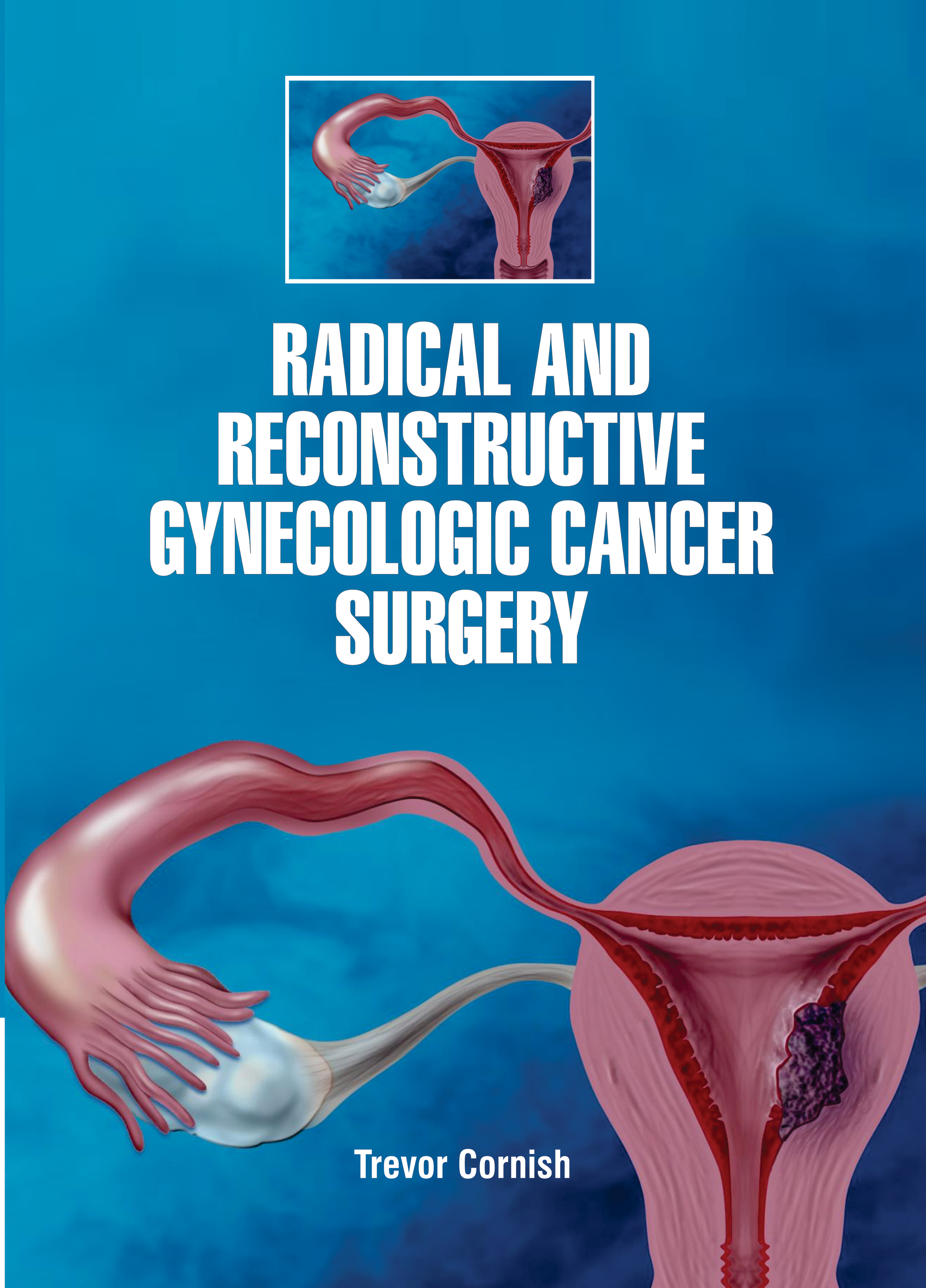 Radical and Reconstructive Gynecologic Cancer Surgery