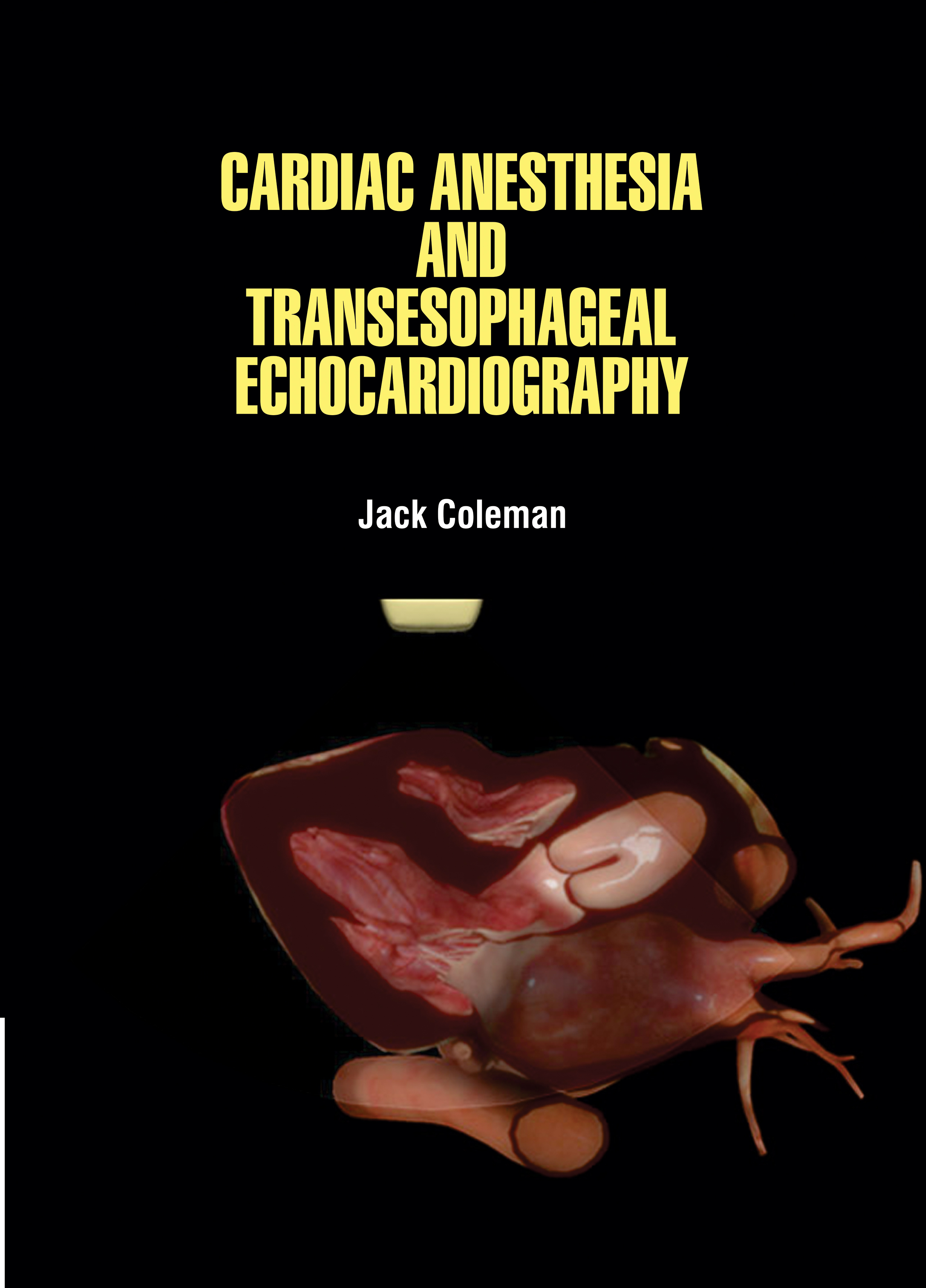 Cardiac Anesthesia and Transesophageal Echocardiography