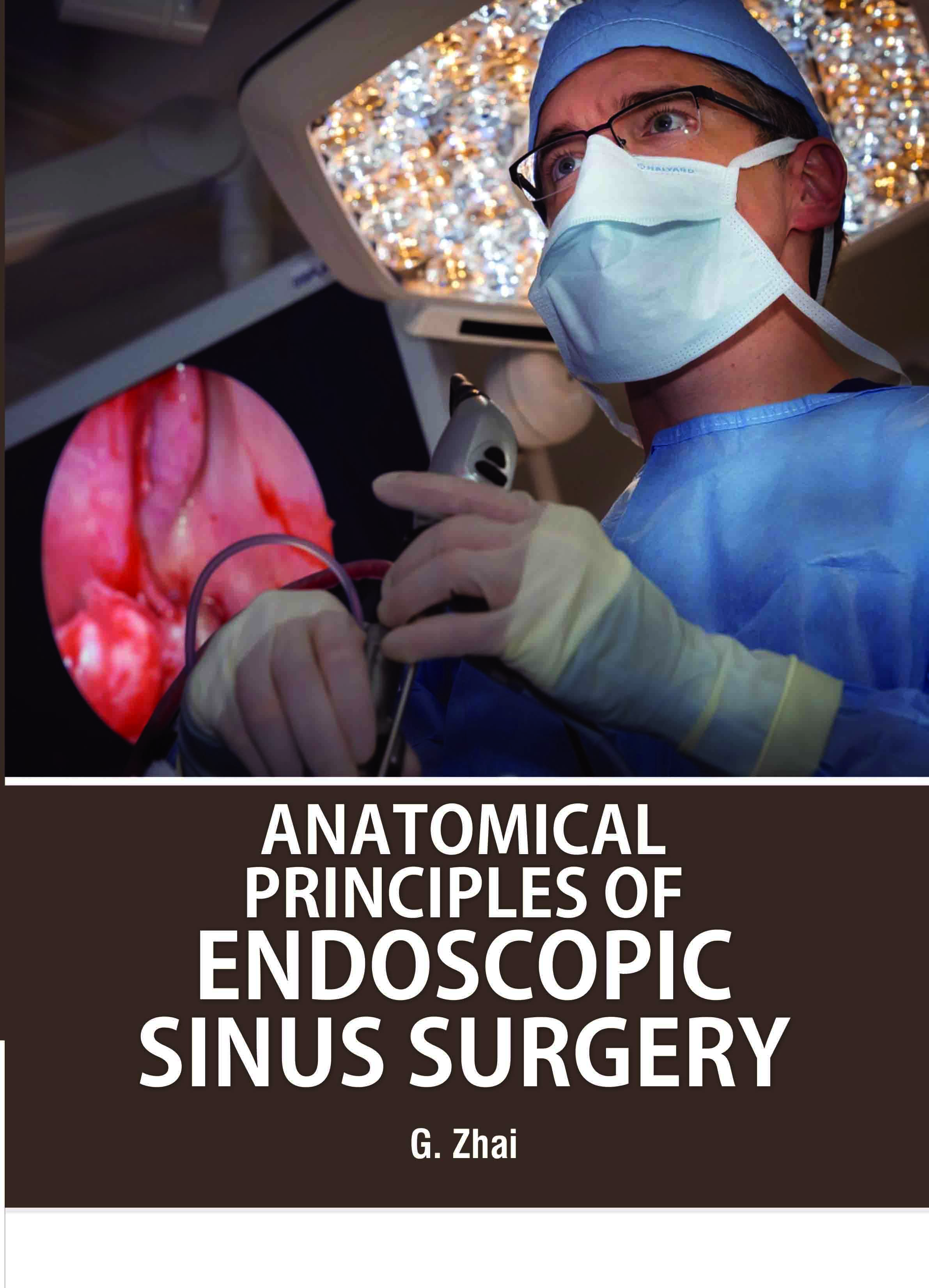 Anatomical Principles of Endoscopic Sinus Surgery
