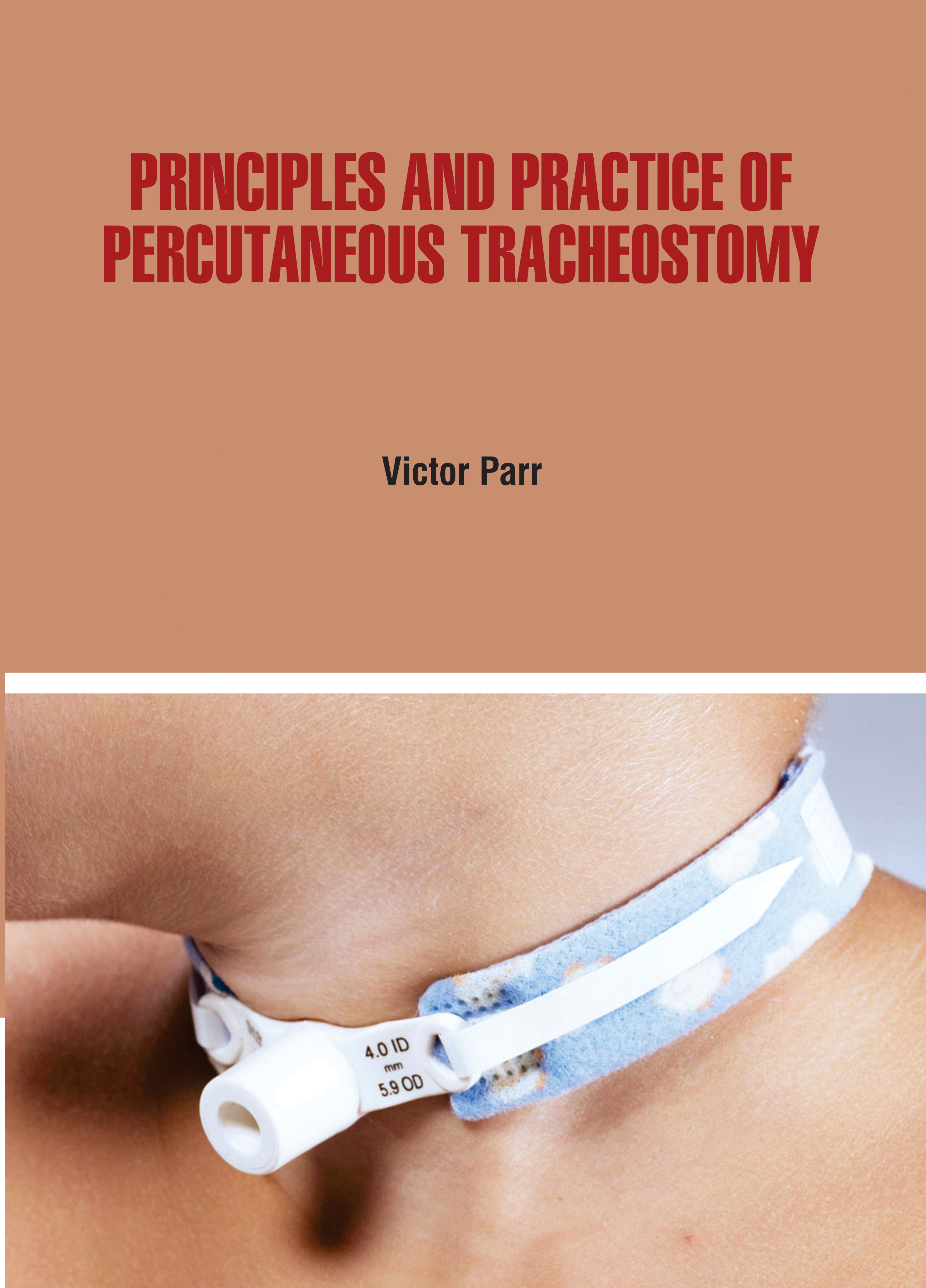 Principles and Practice of Percutaneous Tracheostomy