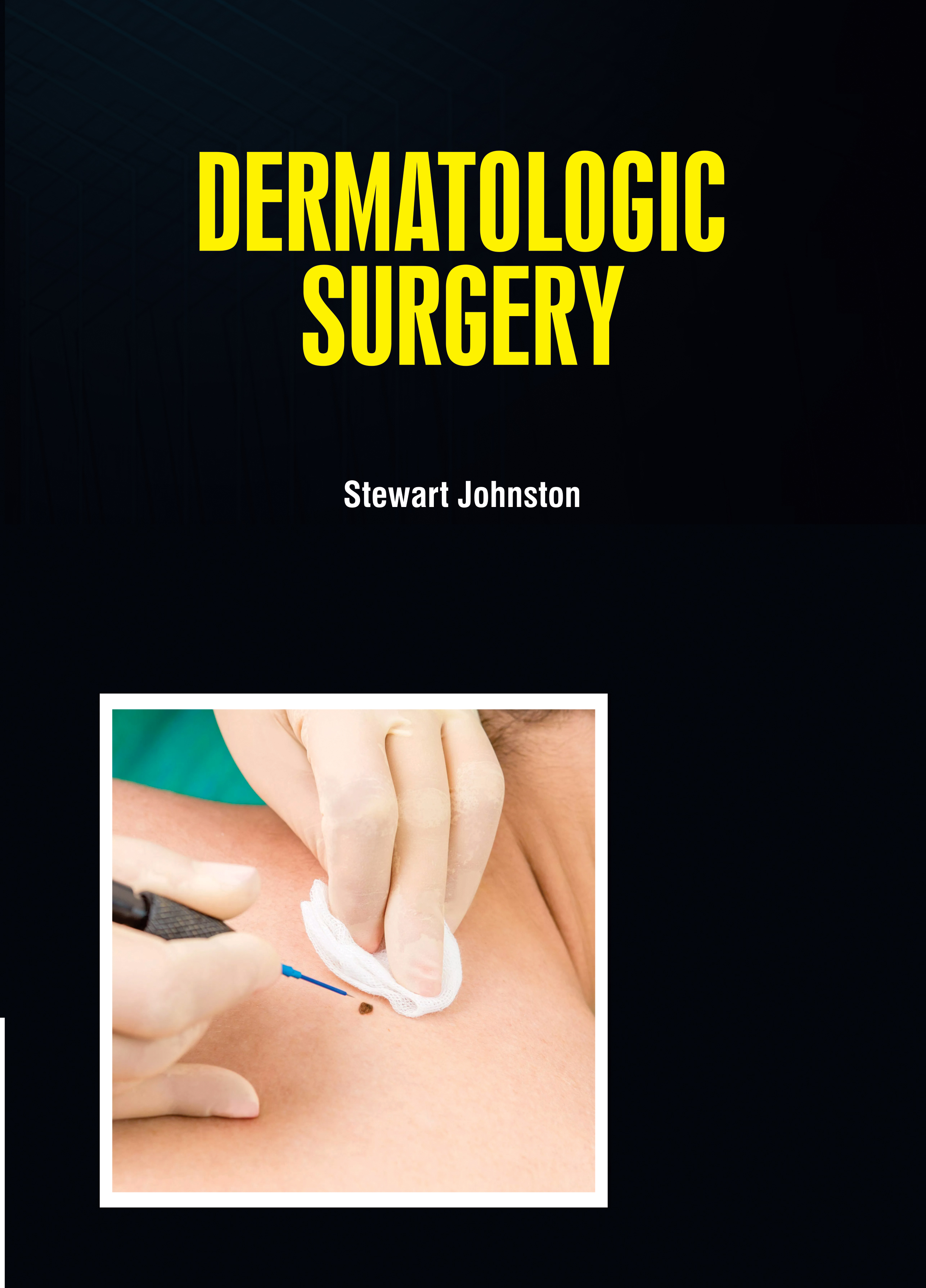 Dermatologic Surgery