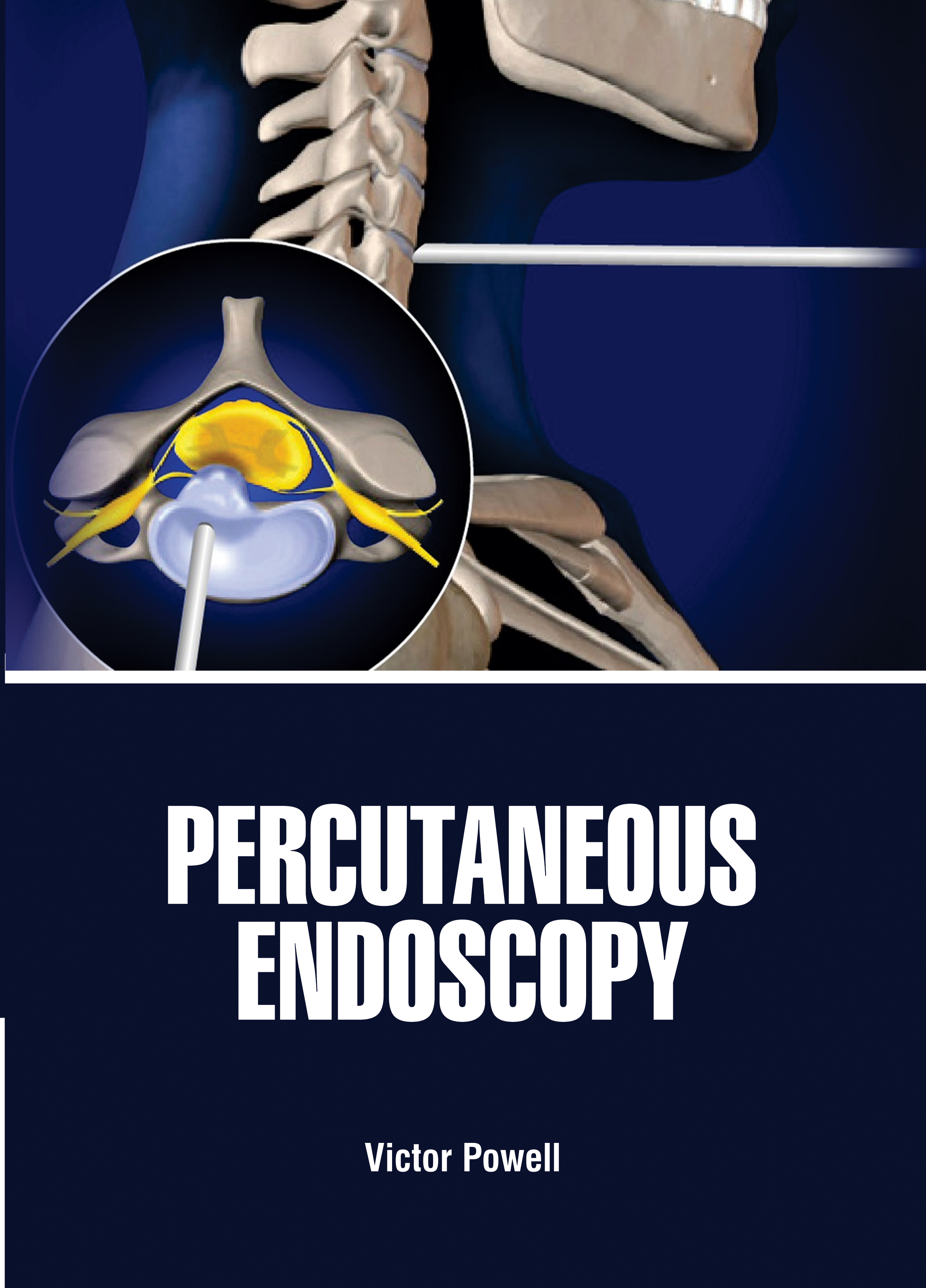 Percutaneous Endoscopy