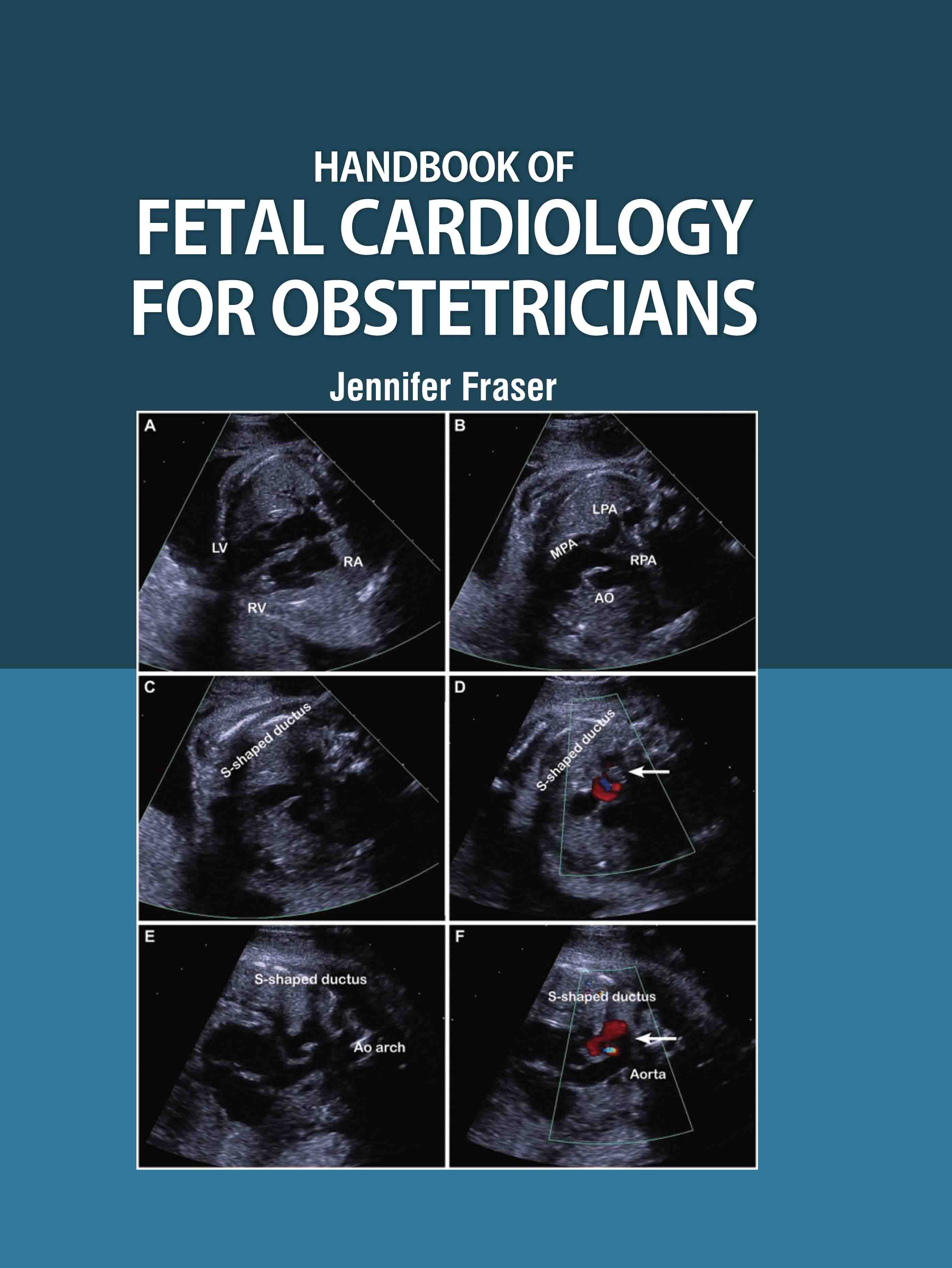 Handbook of Fetal Cardiology for Obstetricians