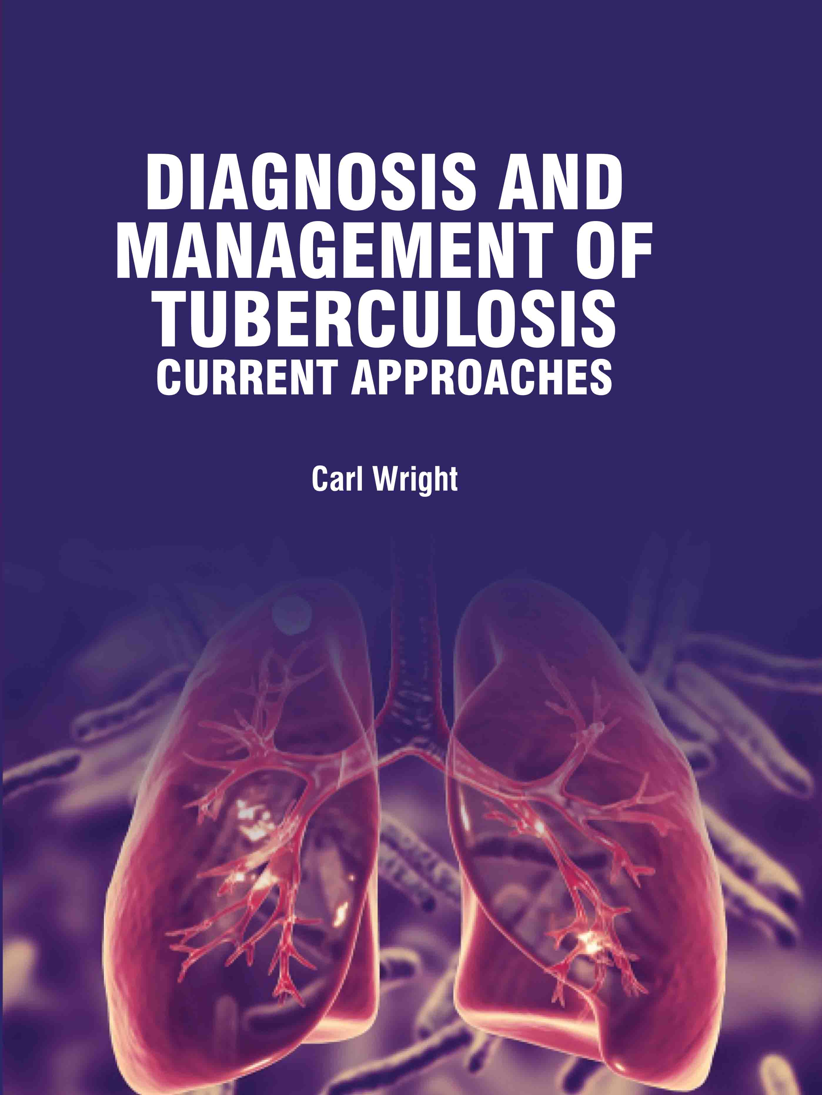 Diagnosis and Management of Tuberculosis: Current Approaches