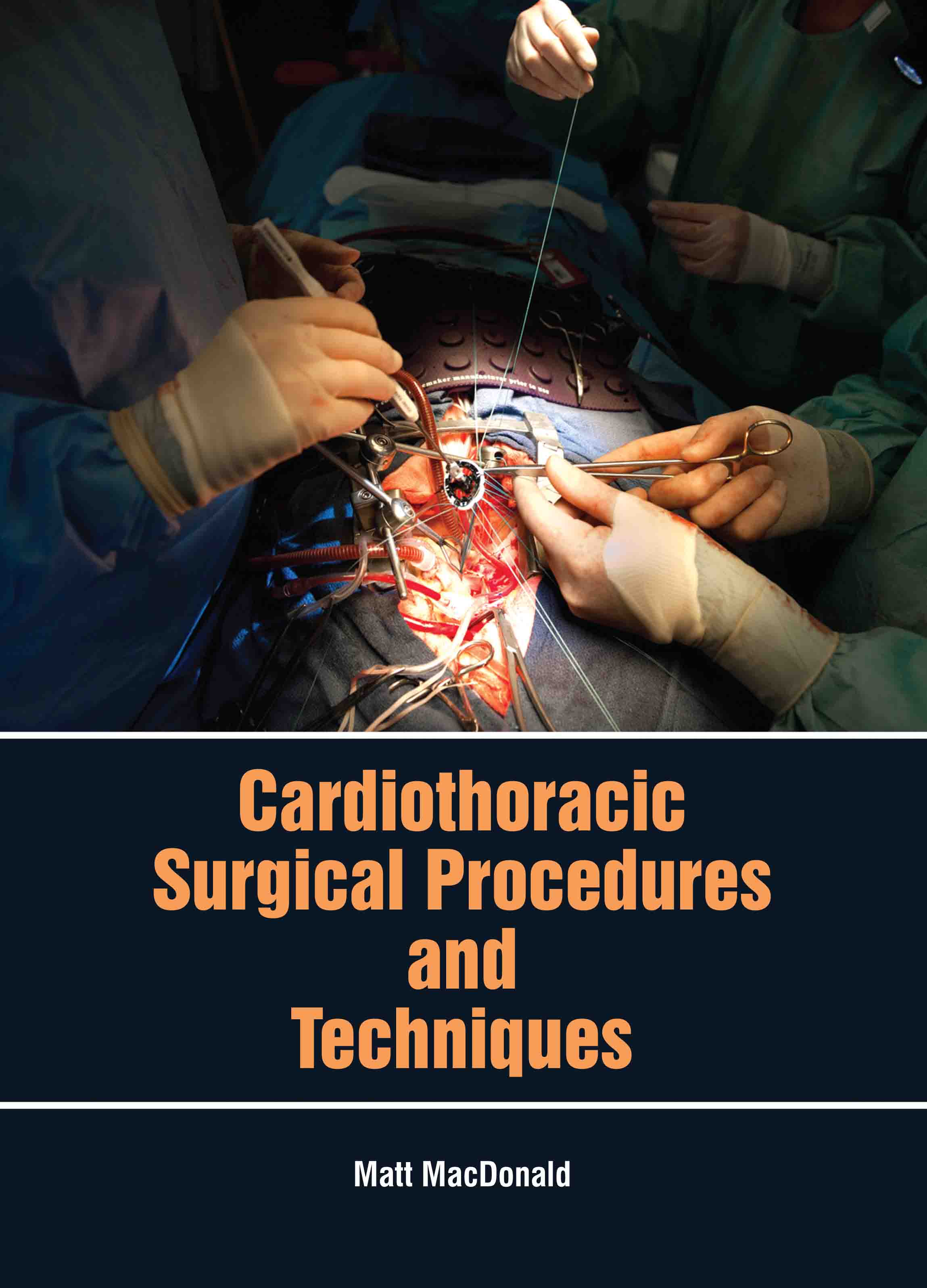 Cardiothoracic Surgical Procedures and Techniques