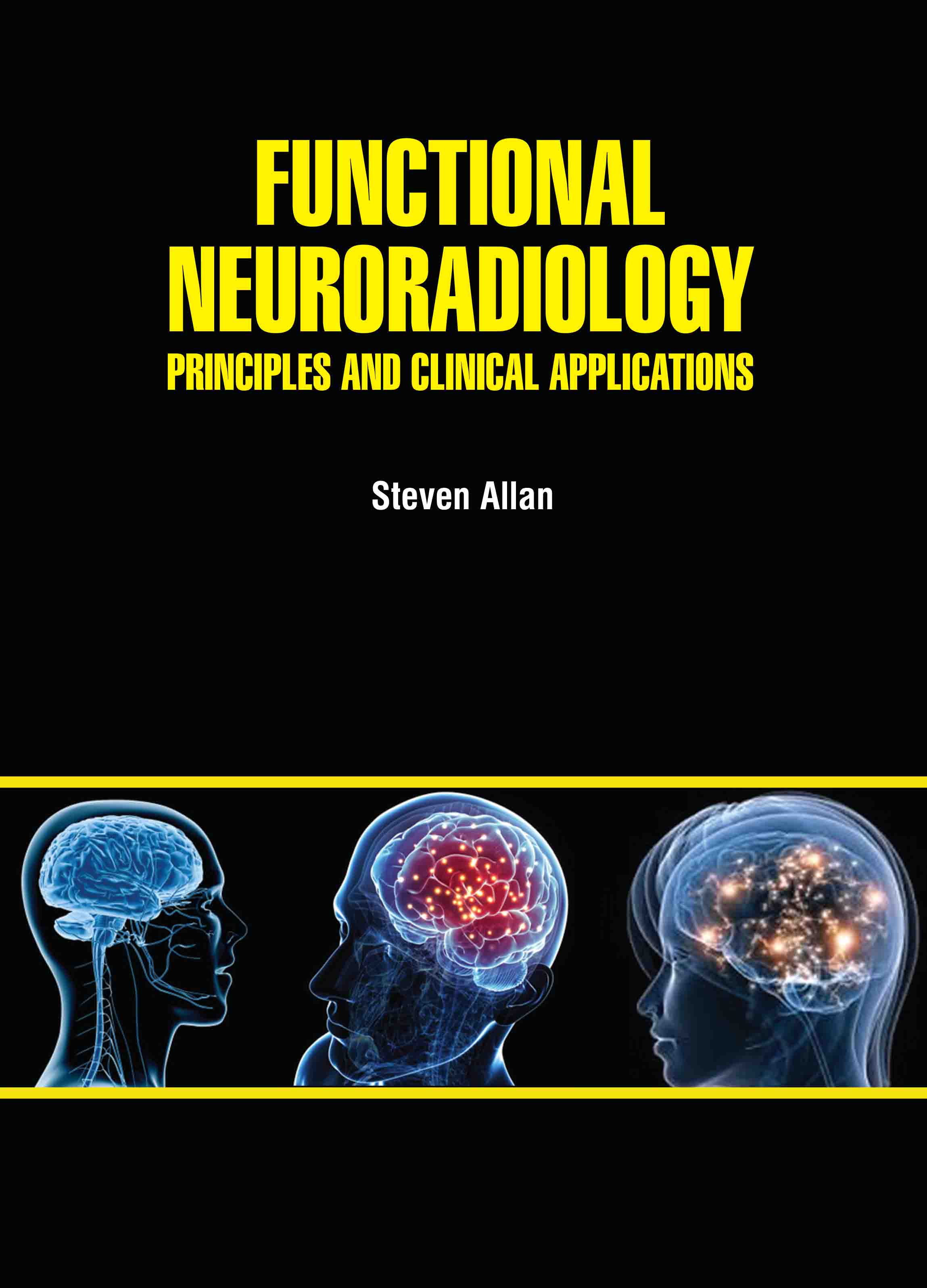 Functional Neuroradiology: Principles and Clinical Applications
