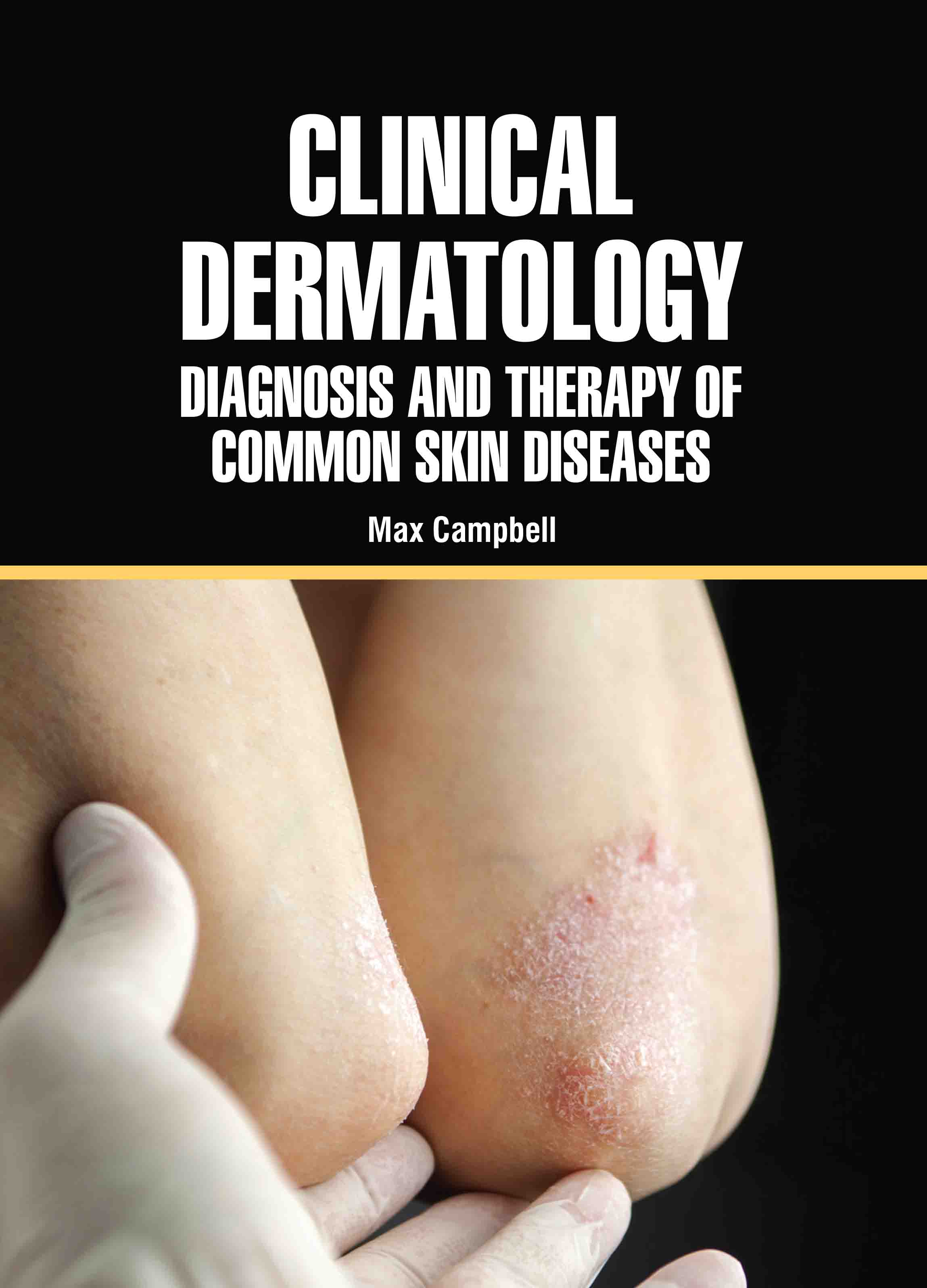 Clinical Dermatology: Diagnosis and Therapy of Common Skin Diseases