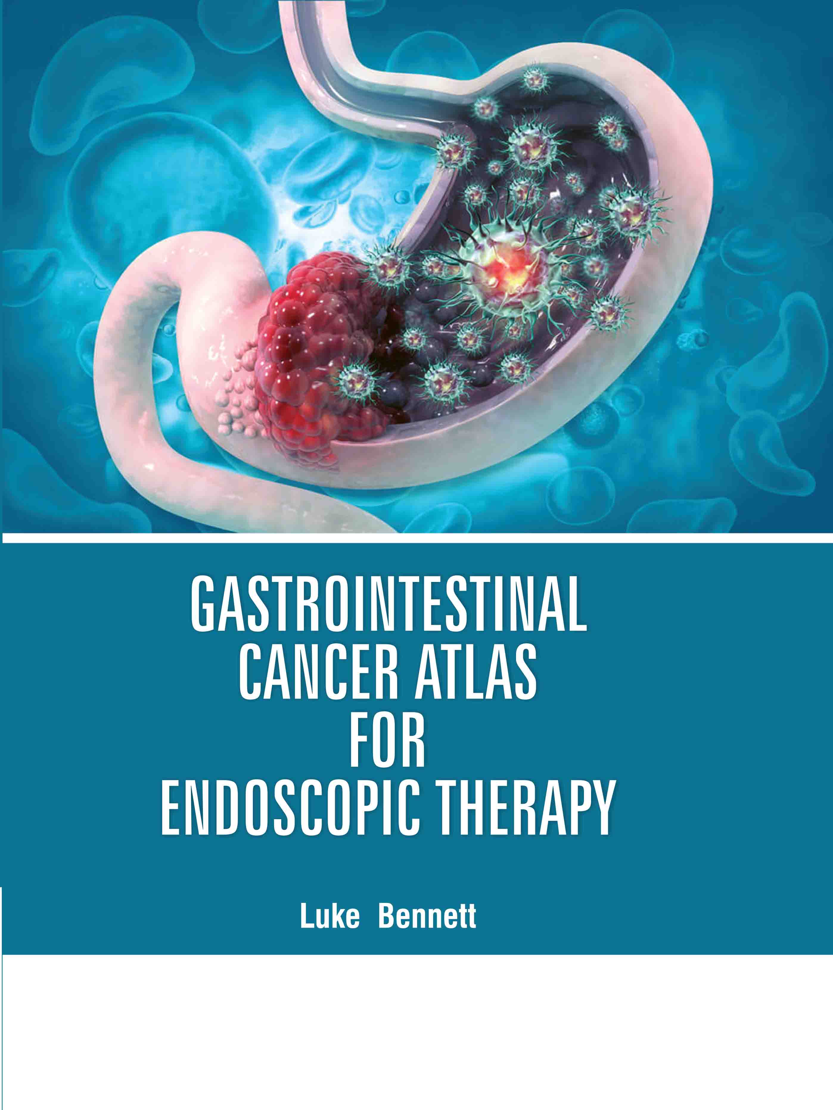 Gastrointestinal Cancer Atlas for Endoscopic Therapy