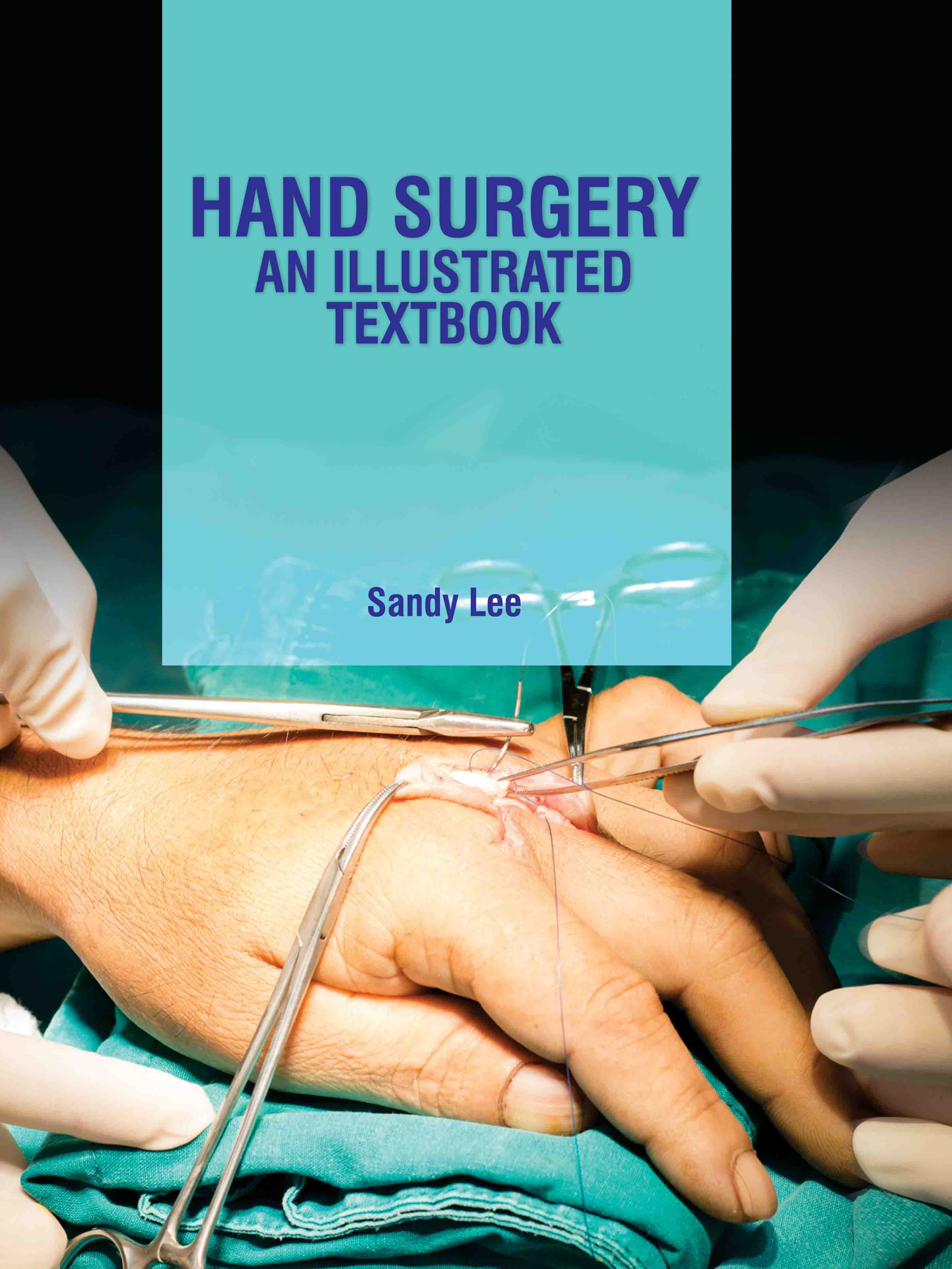 Hand Surgery: An Illustrated Textbook