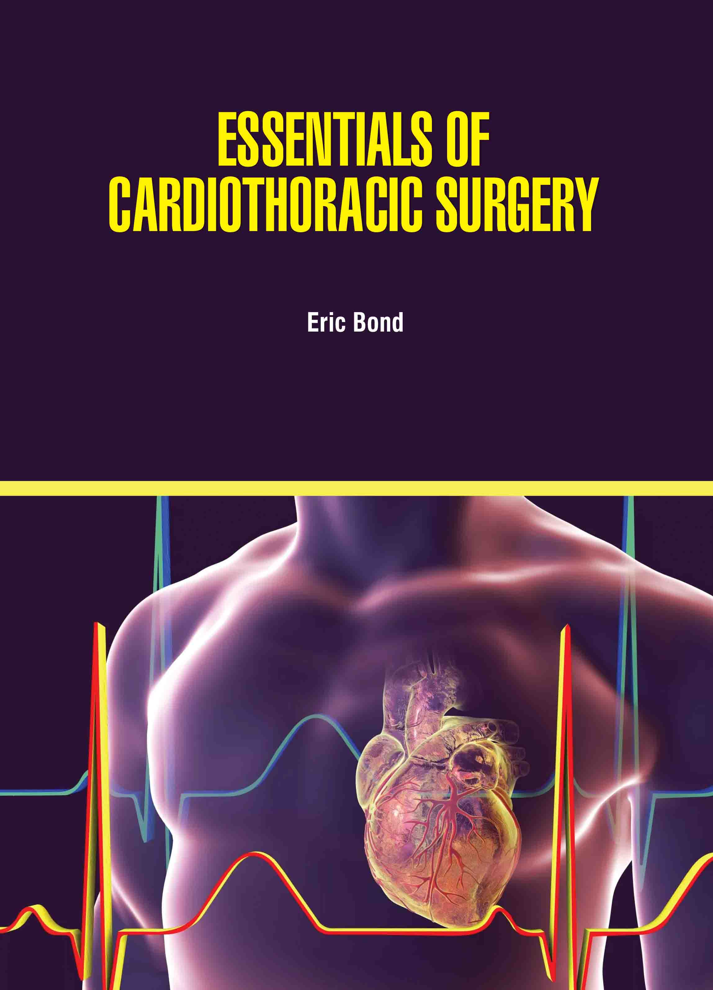 Essentials of Cardiothoracic Surgery
