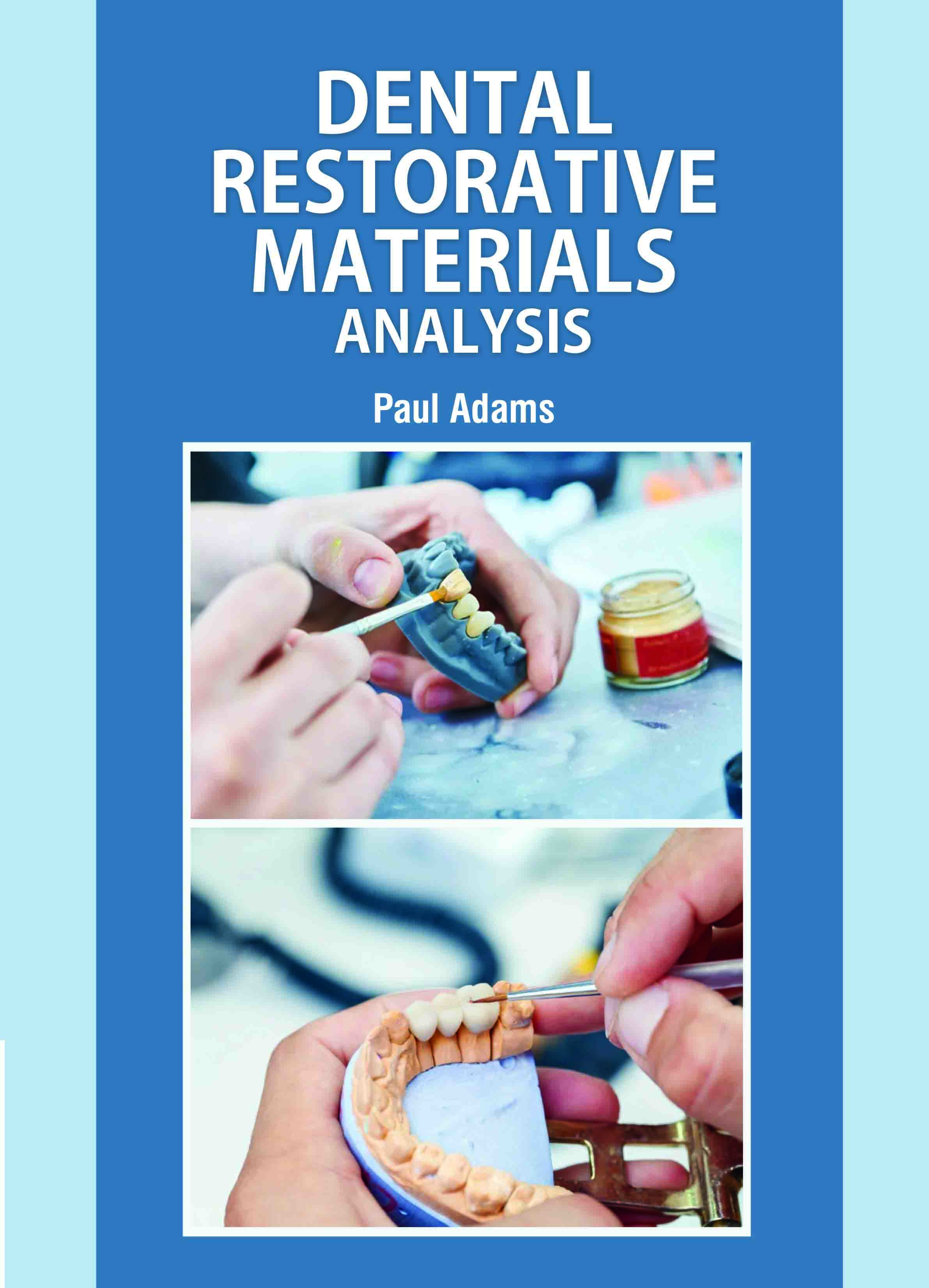 Dental Restorative Materials: Analysis