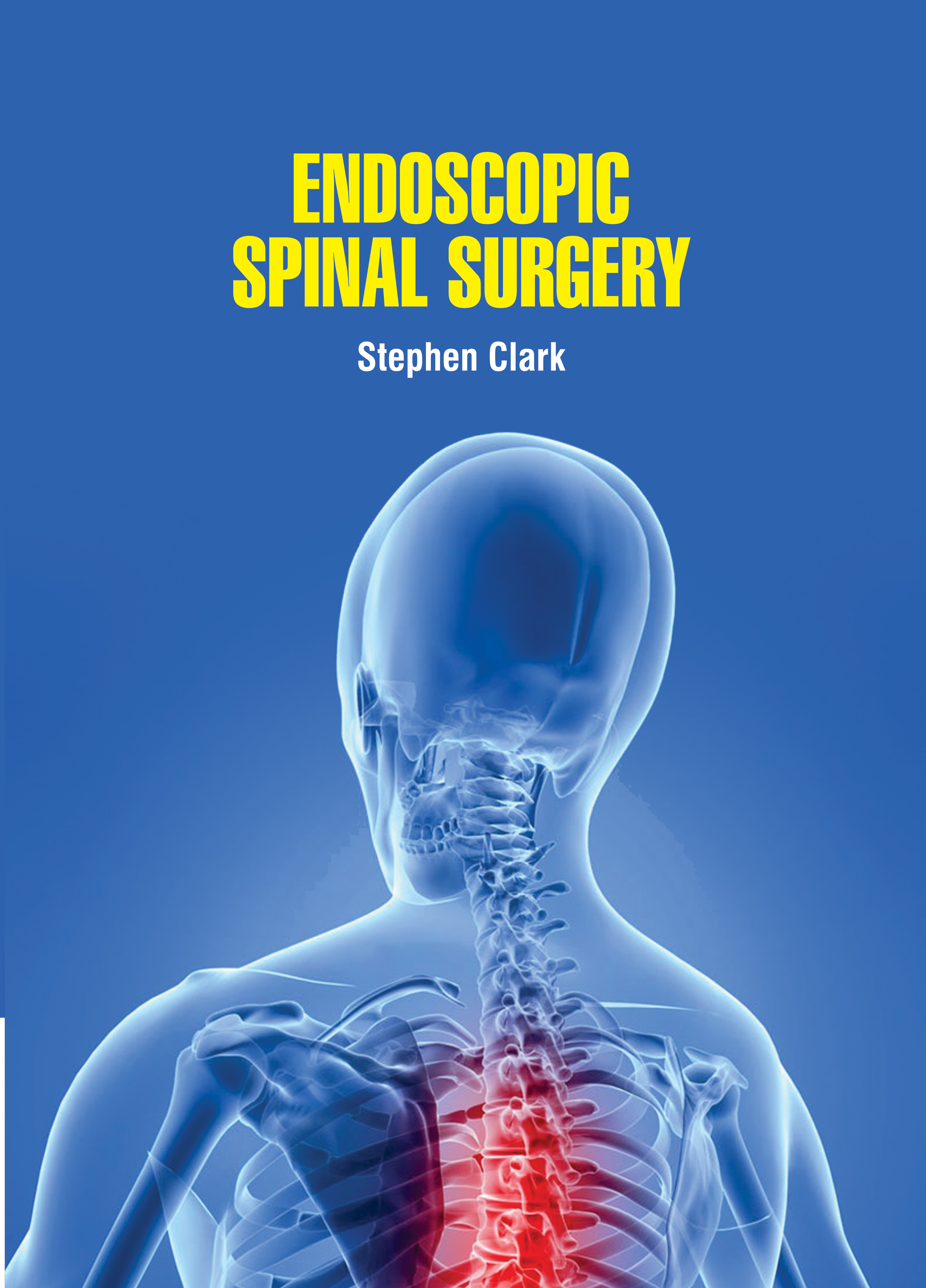 Endoscopic Spinal Surgery