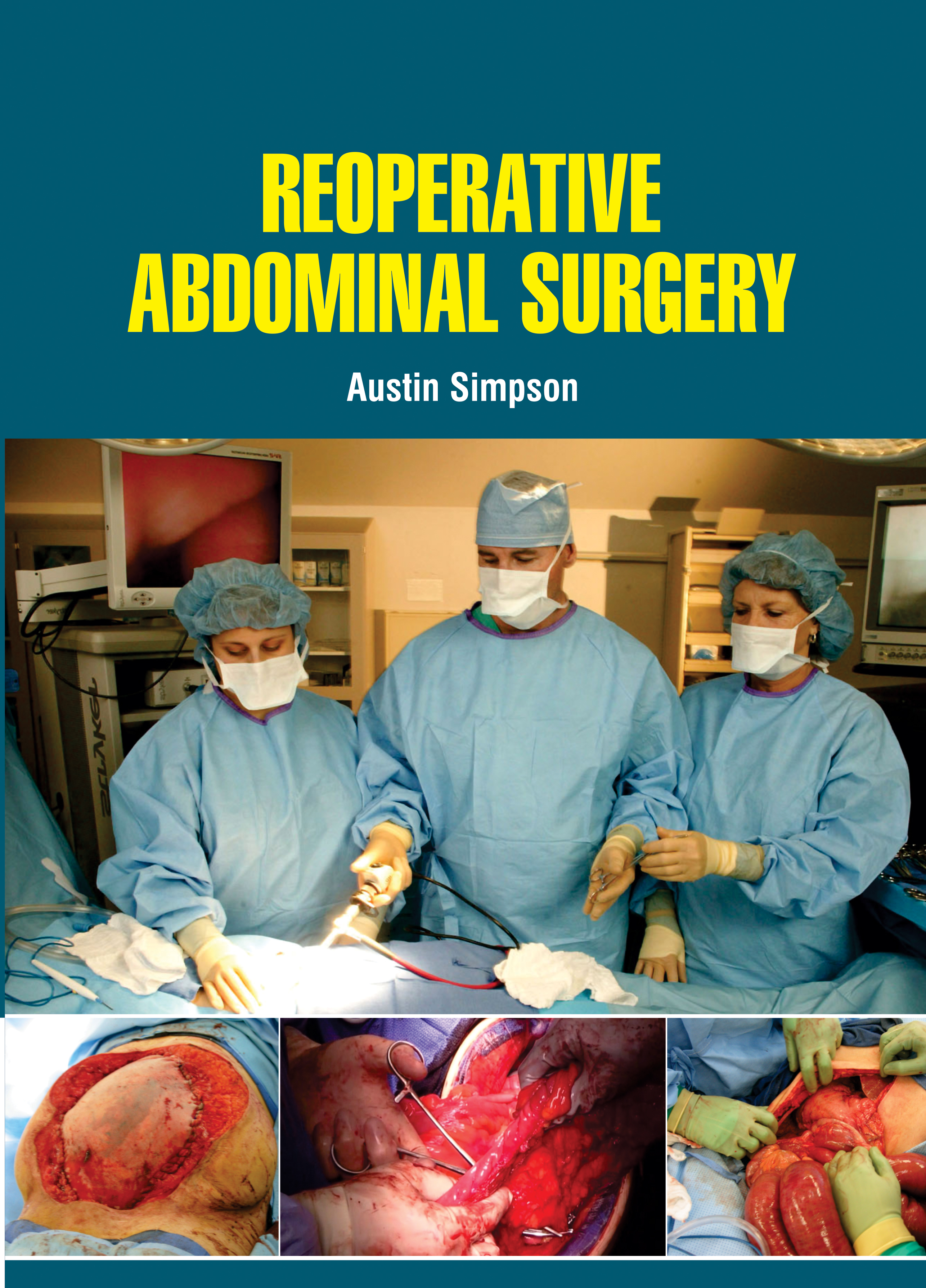Reoperative Abdominal Surgery