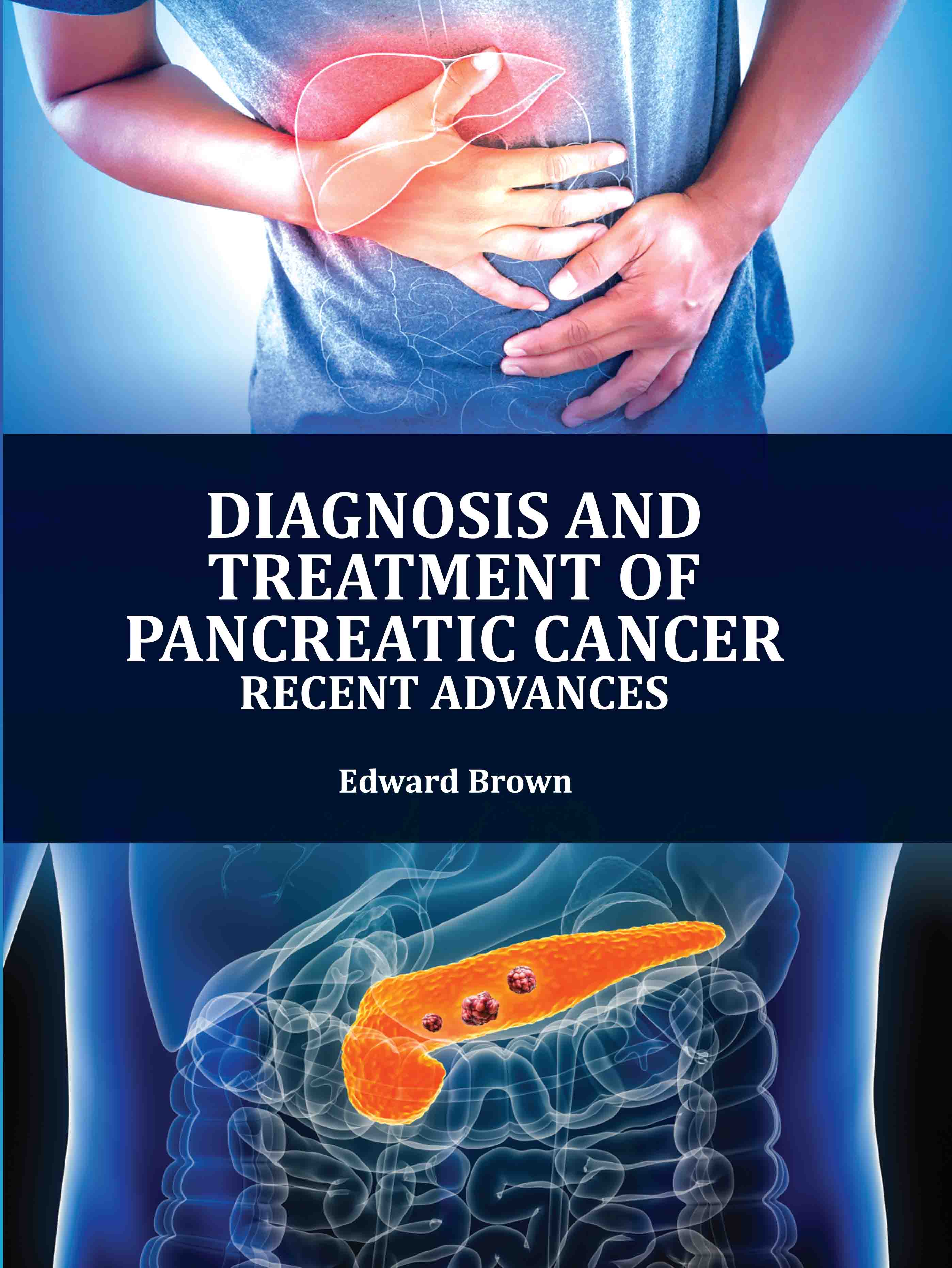 Diagnosis and Treatment of Pancreatic Cancer: Recent Advances