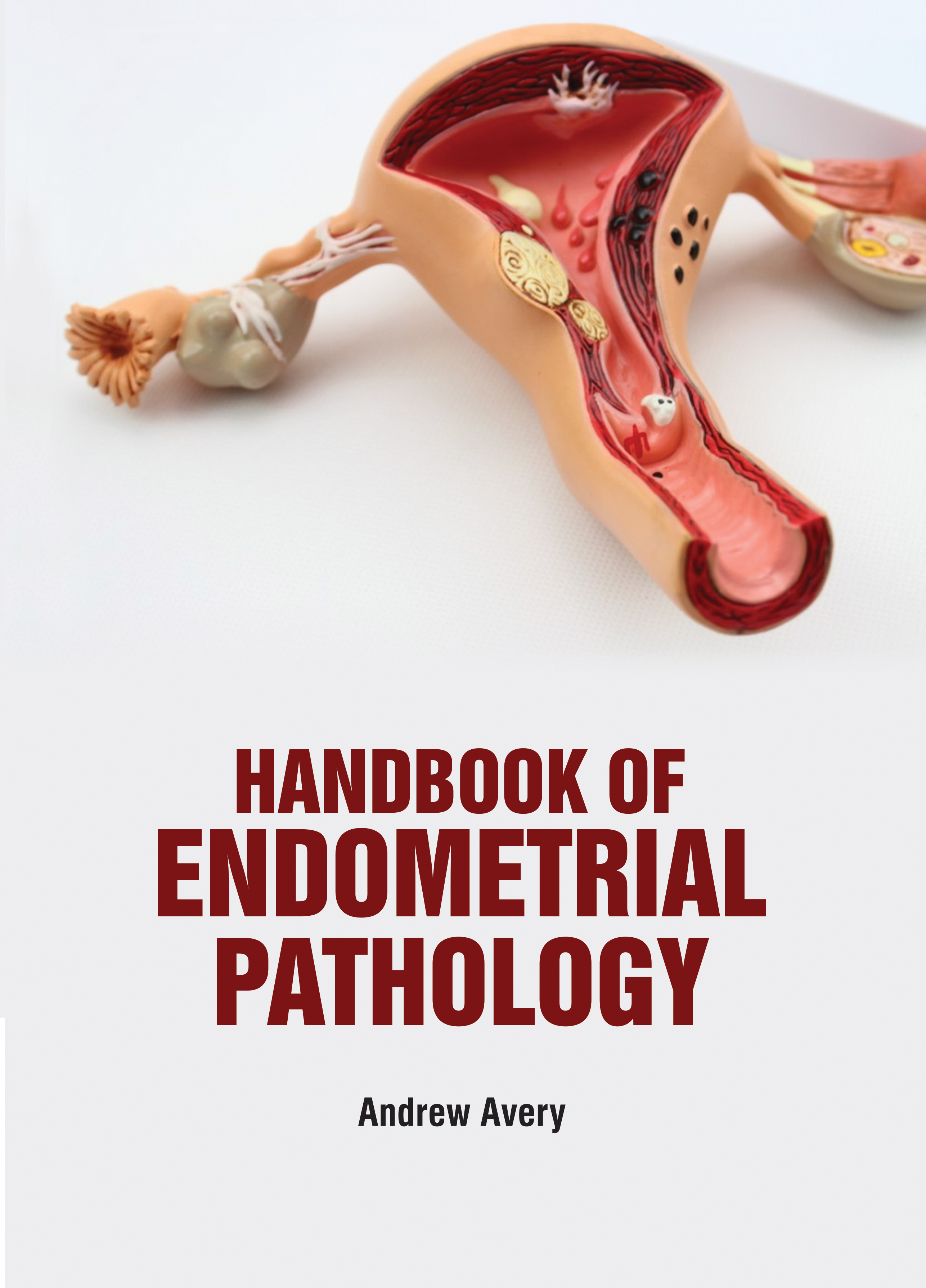 Handbook of Endometrial Pathology
