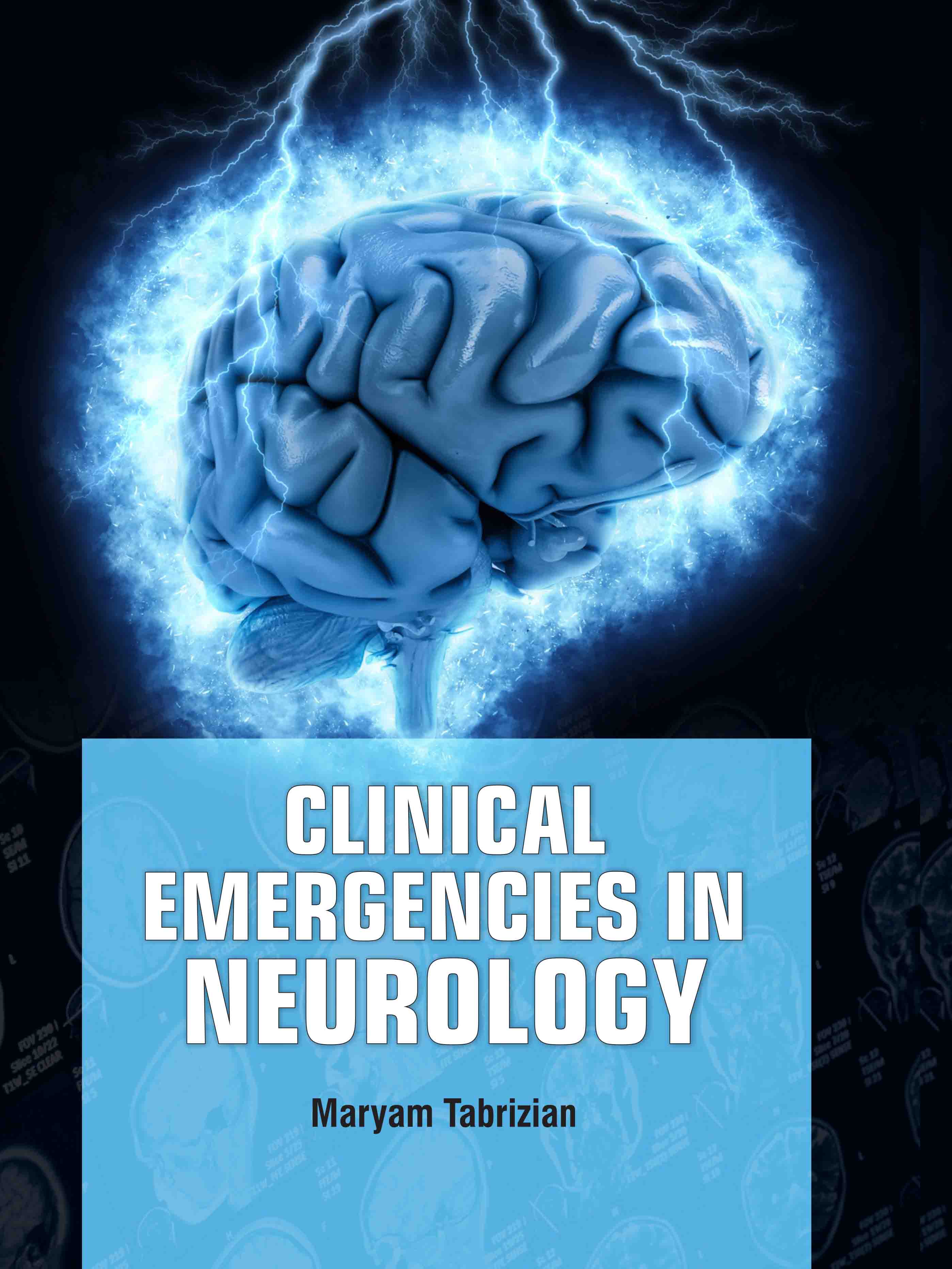 Clinical Emergencies in Neurology
