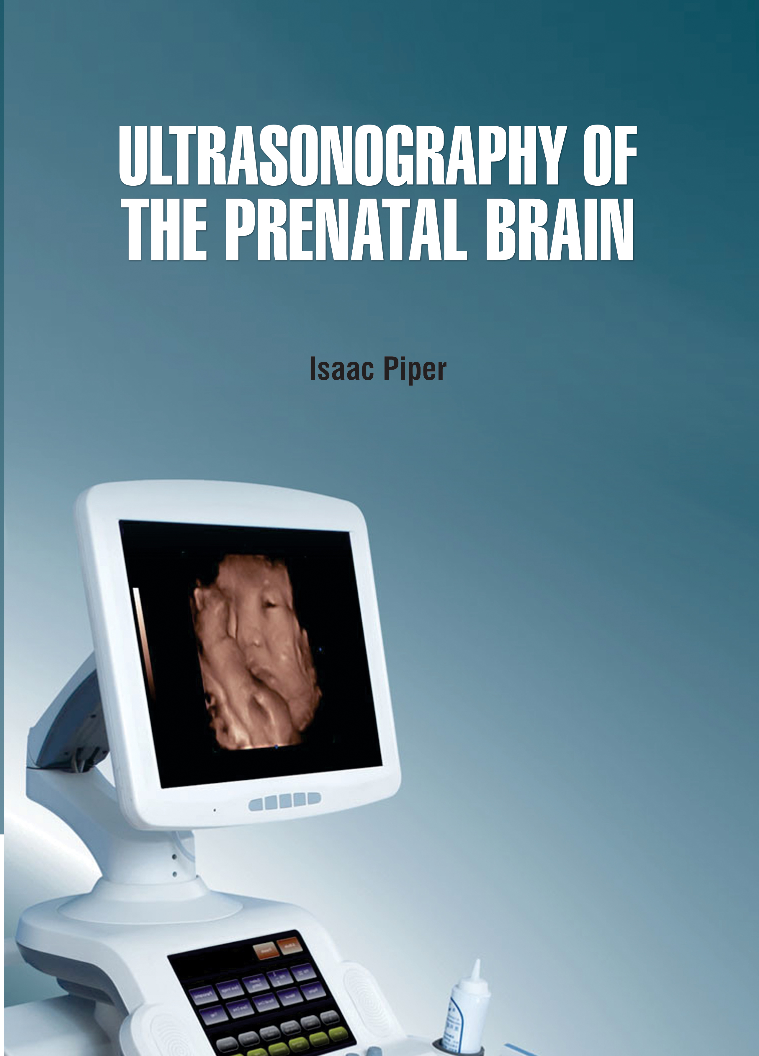Ultrasonography of The Prenatal Brain