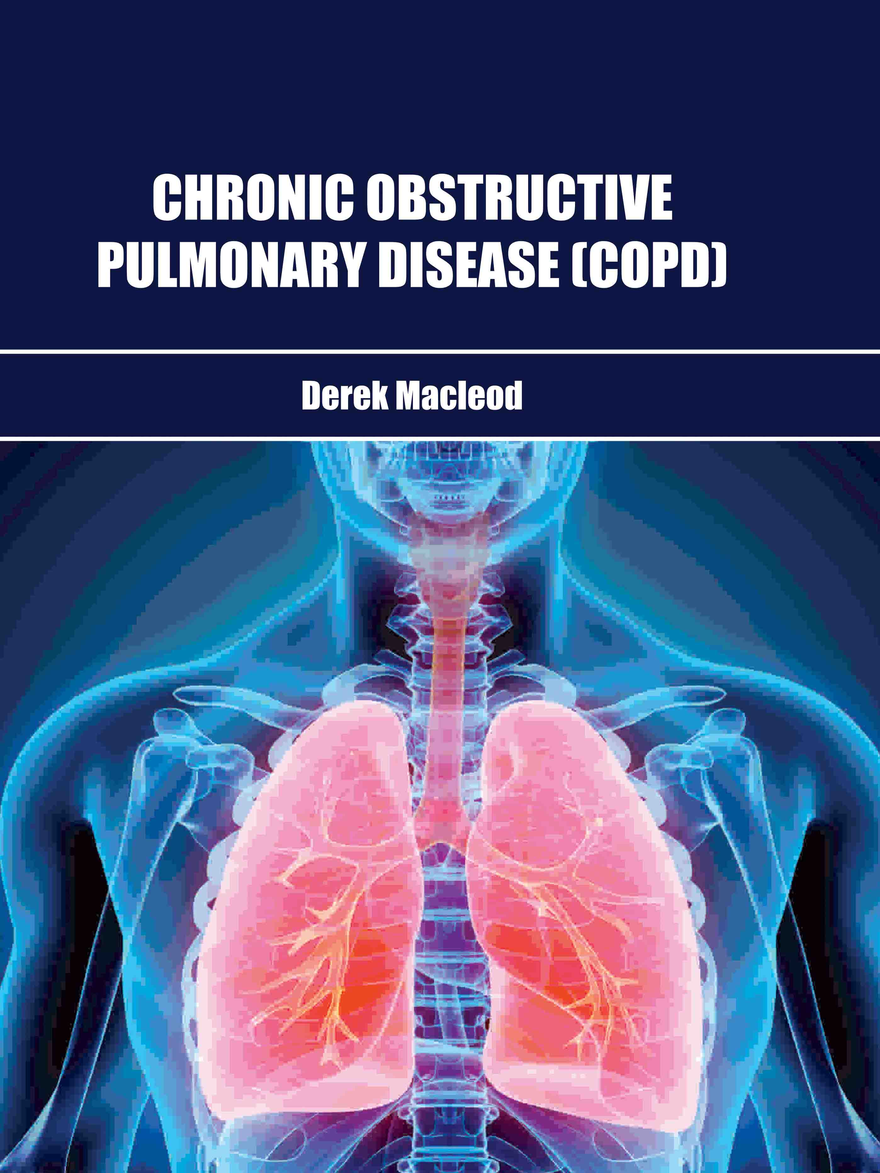 Chronic Obstructive Pulmonary Disease (Copd)