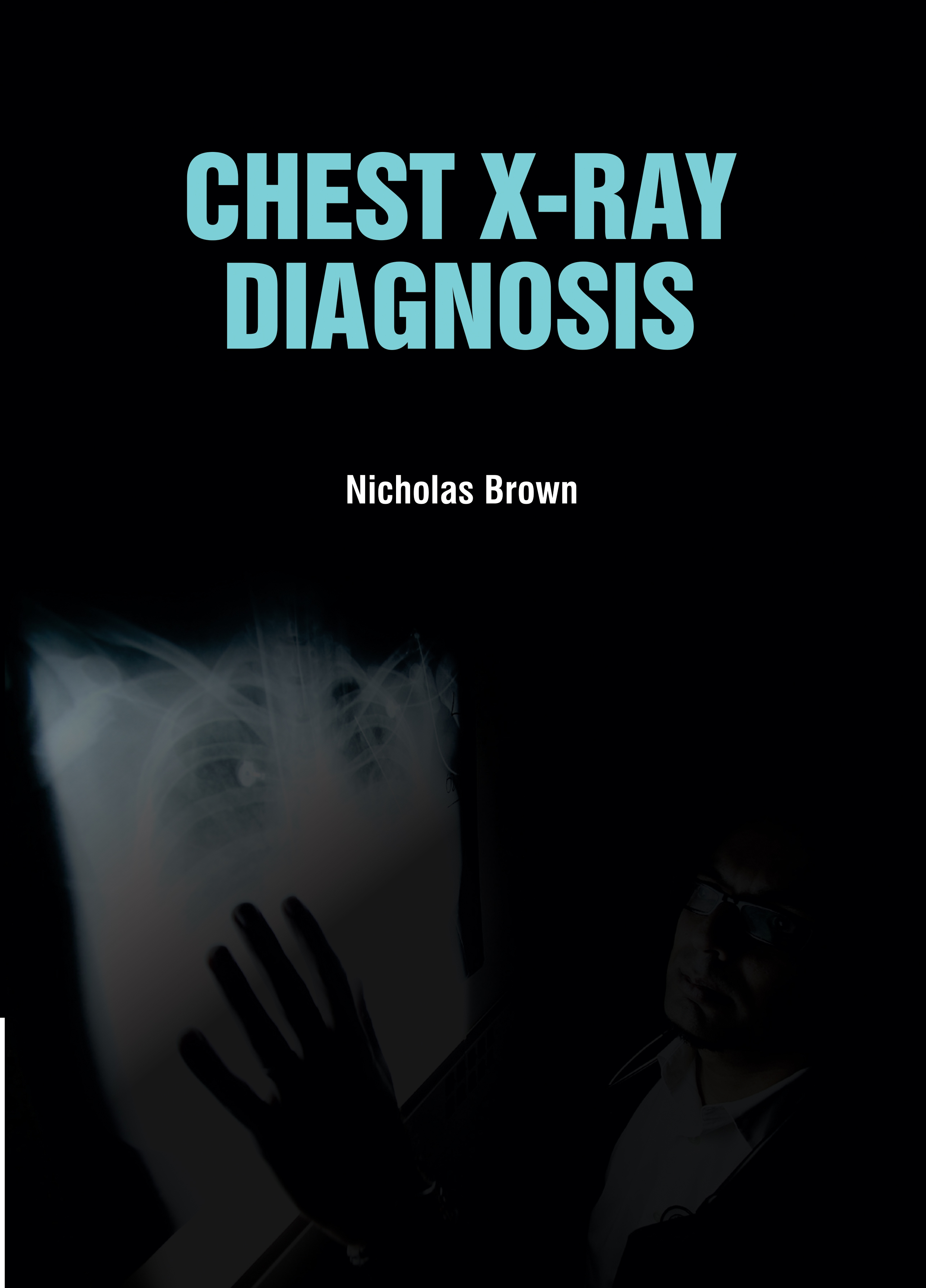 Chest X-Ray Diagnosis