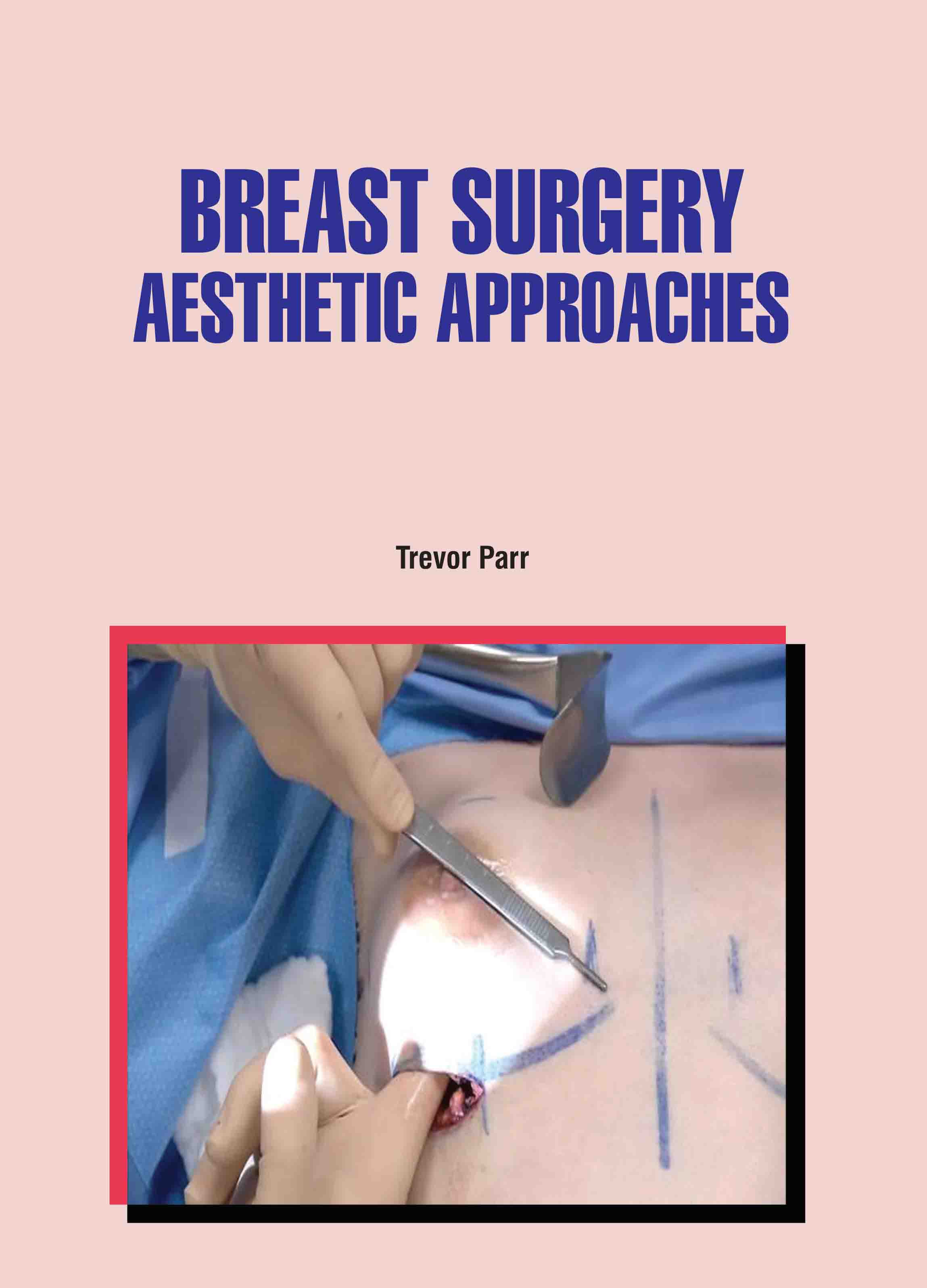 Breast Surgery: Aesthetic Approaches