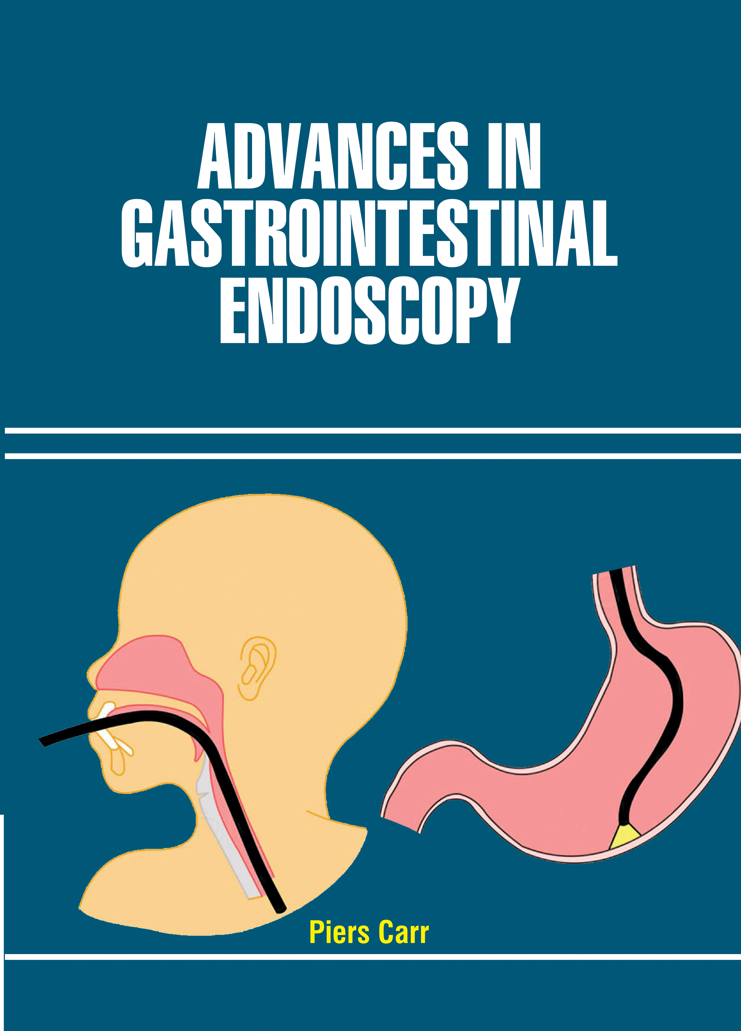 Advances in Gastrointestinal Endoscopy