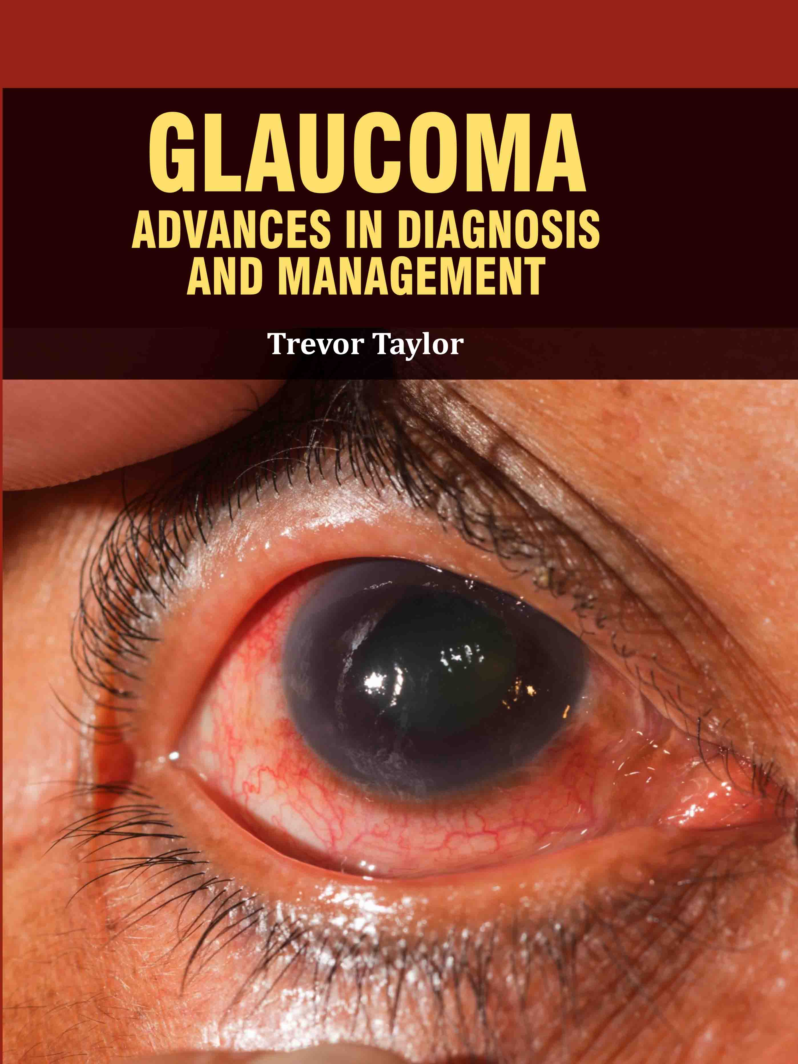 Glaucoma: Advances in Diagnosis and Management