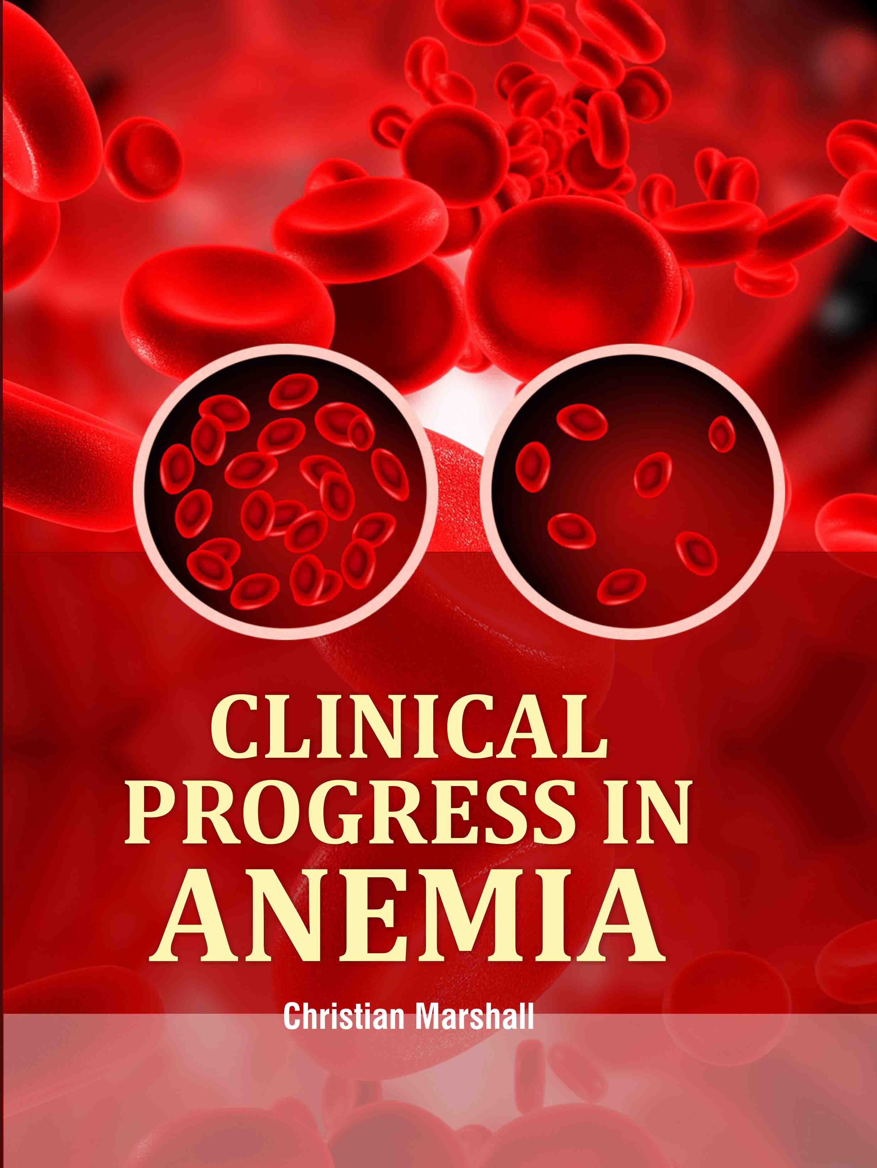 Clinical Progress in Anemia