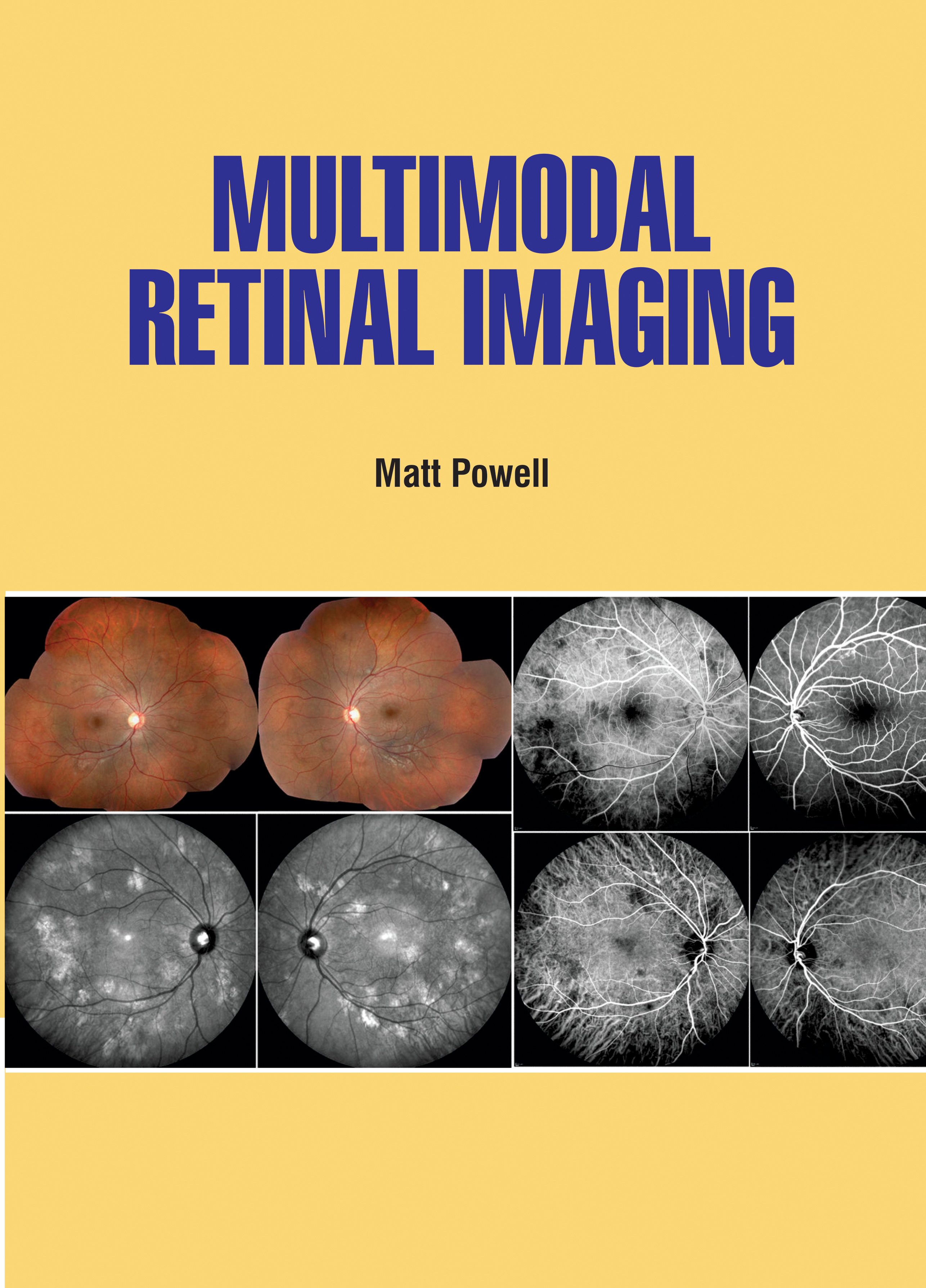 Multimodal Retinal Imaging