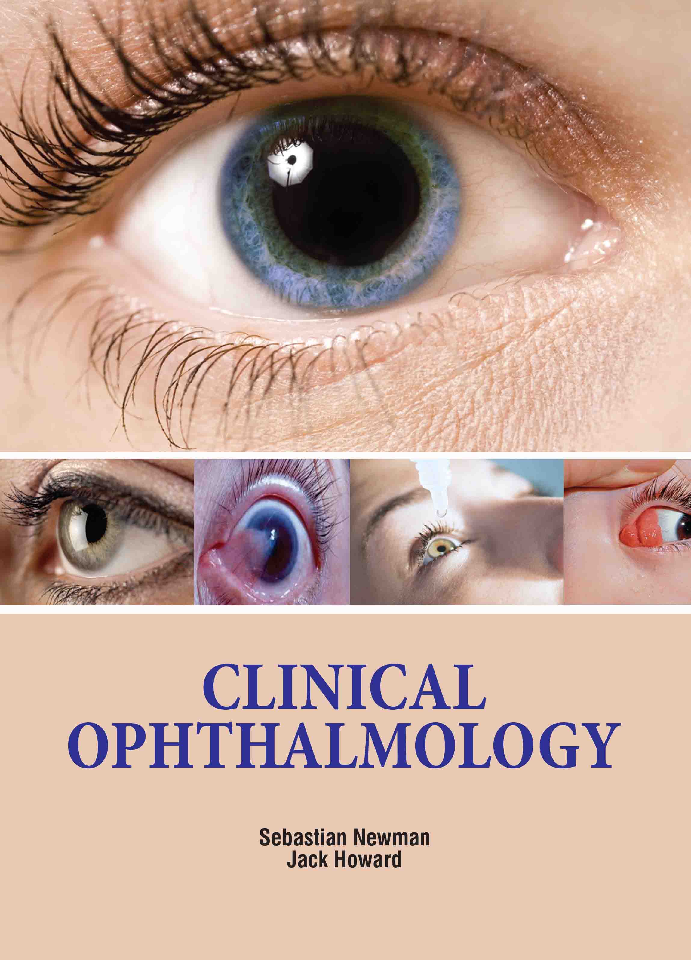 Clinical Ophthalmology