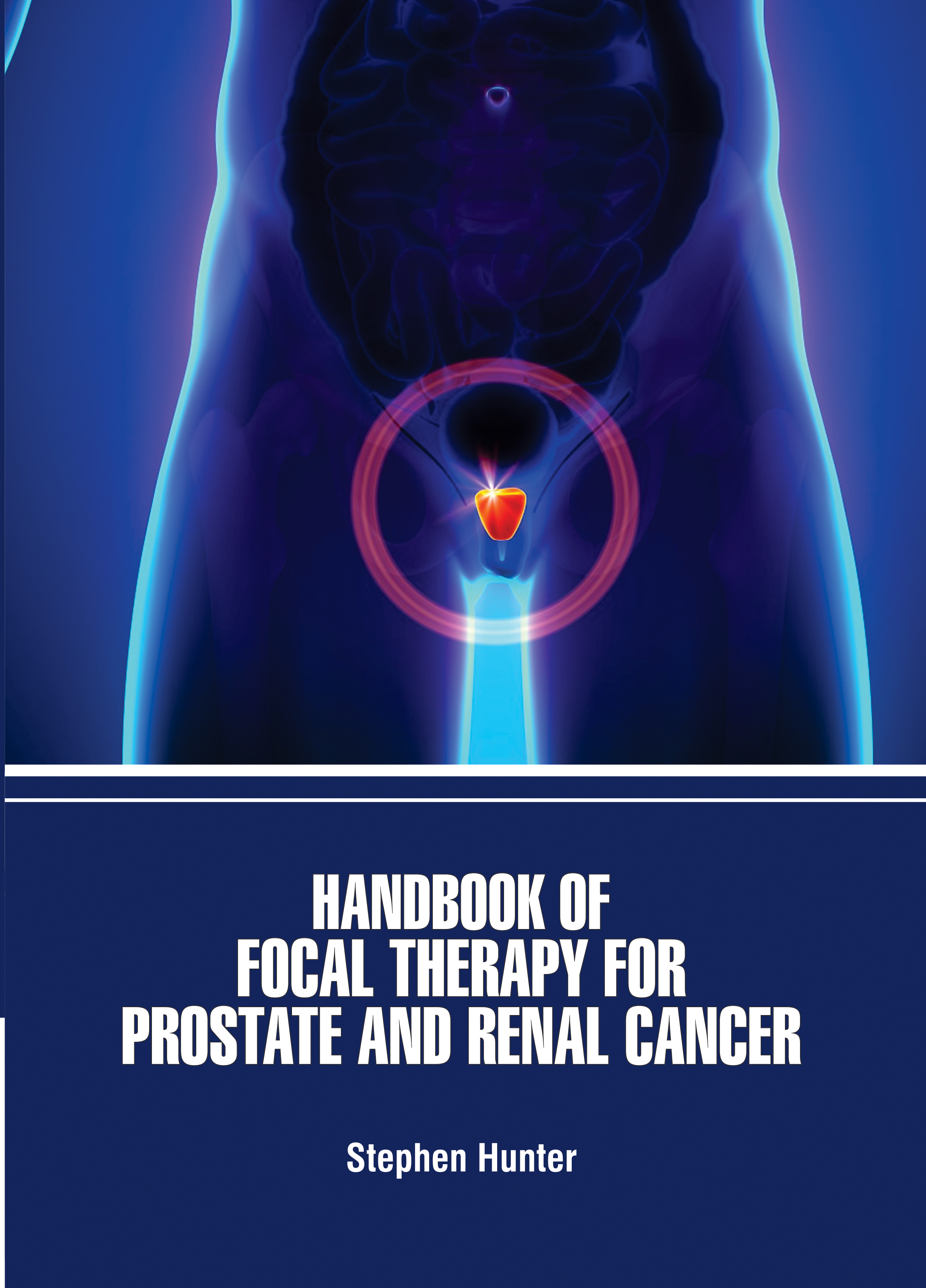 Handbook of Focal Therapy for Prostate and Renal Cancer