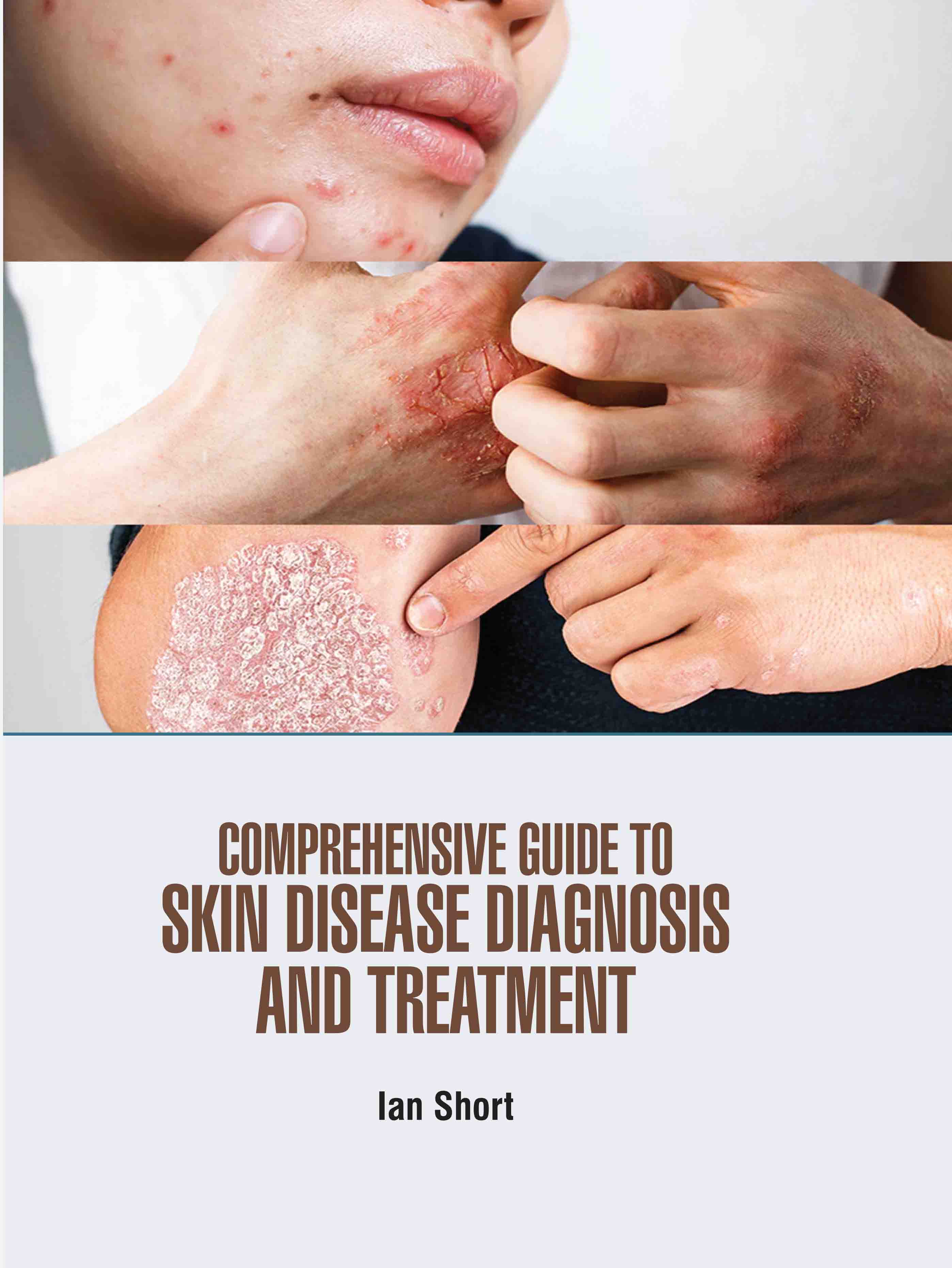Comprehensive Guide to Skin Disease Diagnosis and Treatment