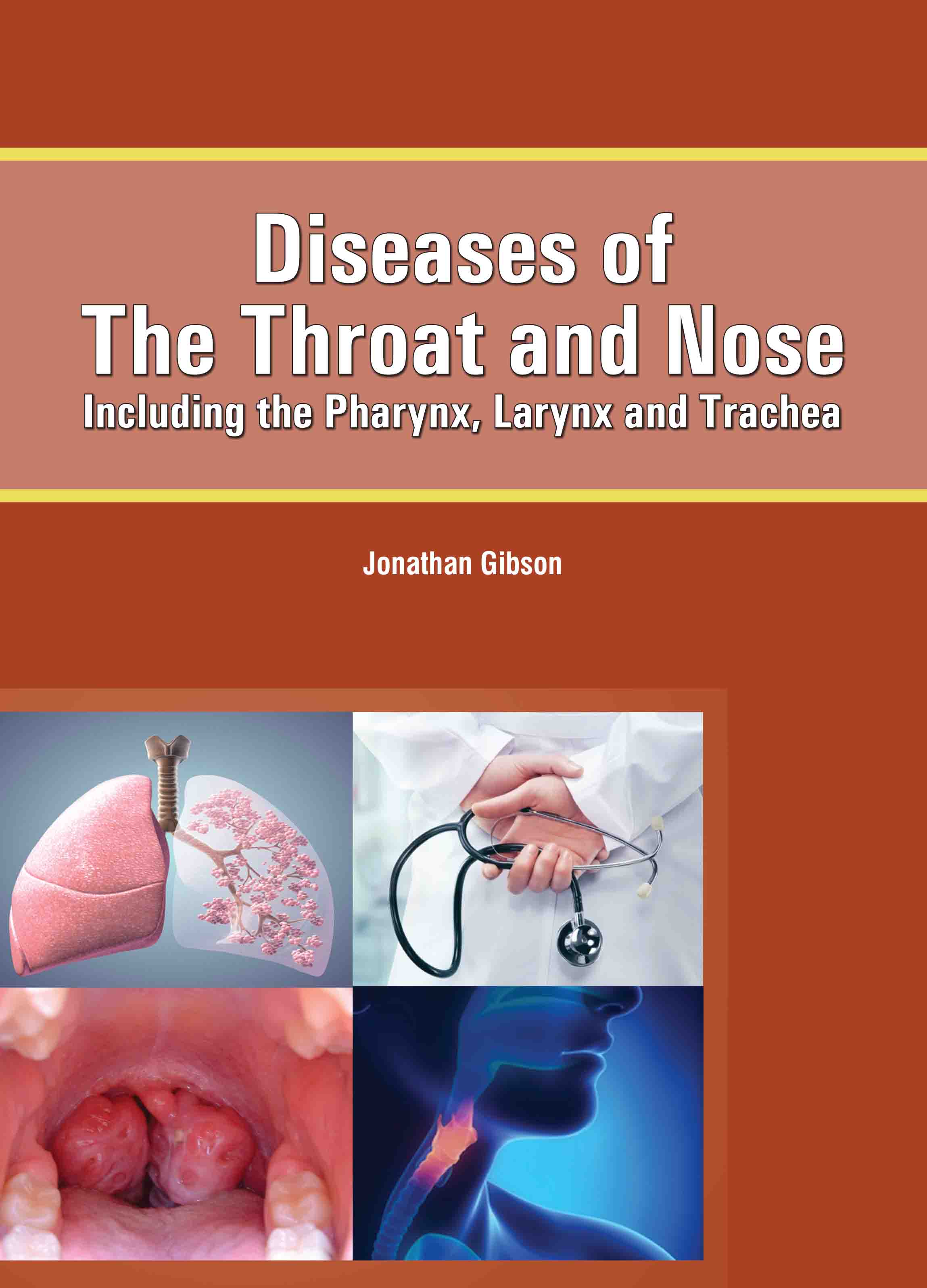 Diseases of The Throat and Nose: Including The Pharynx, Larynx and Trachea