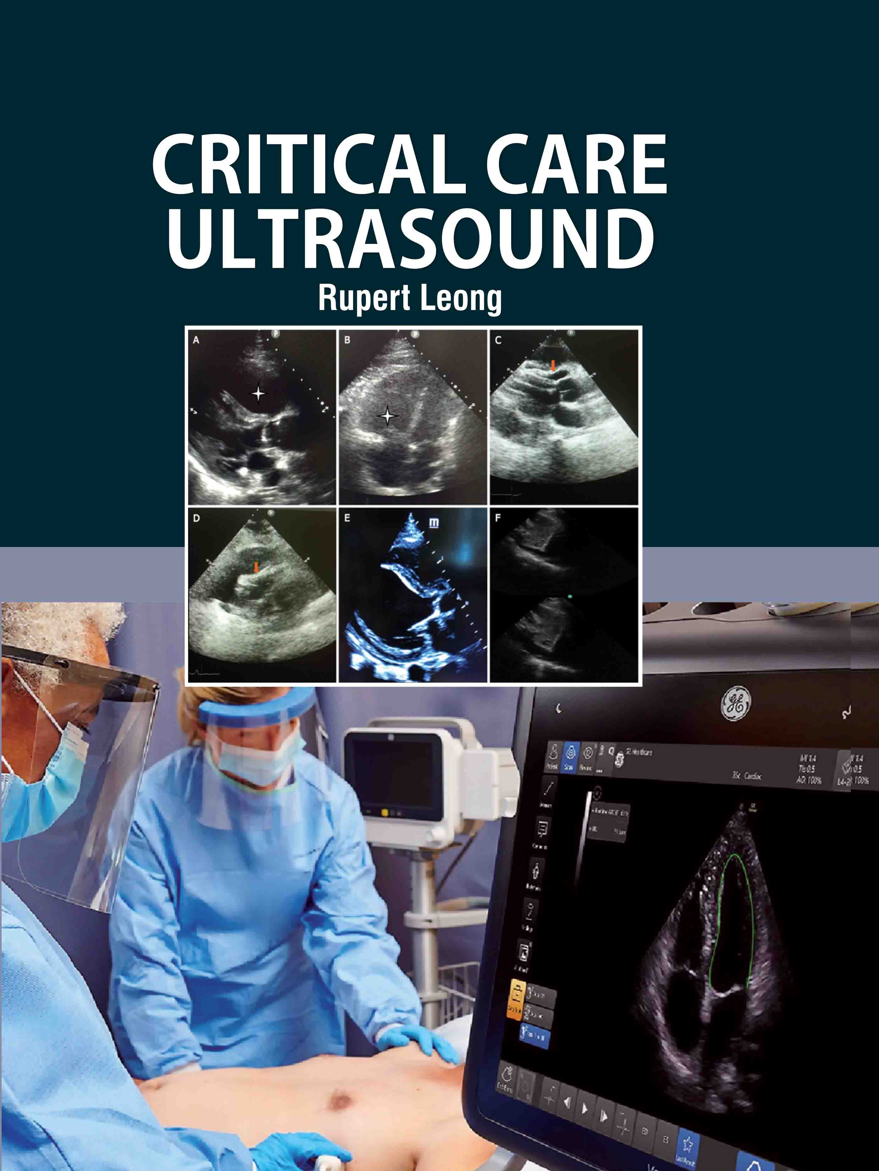 Critical Care Ultrasound