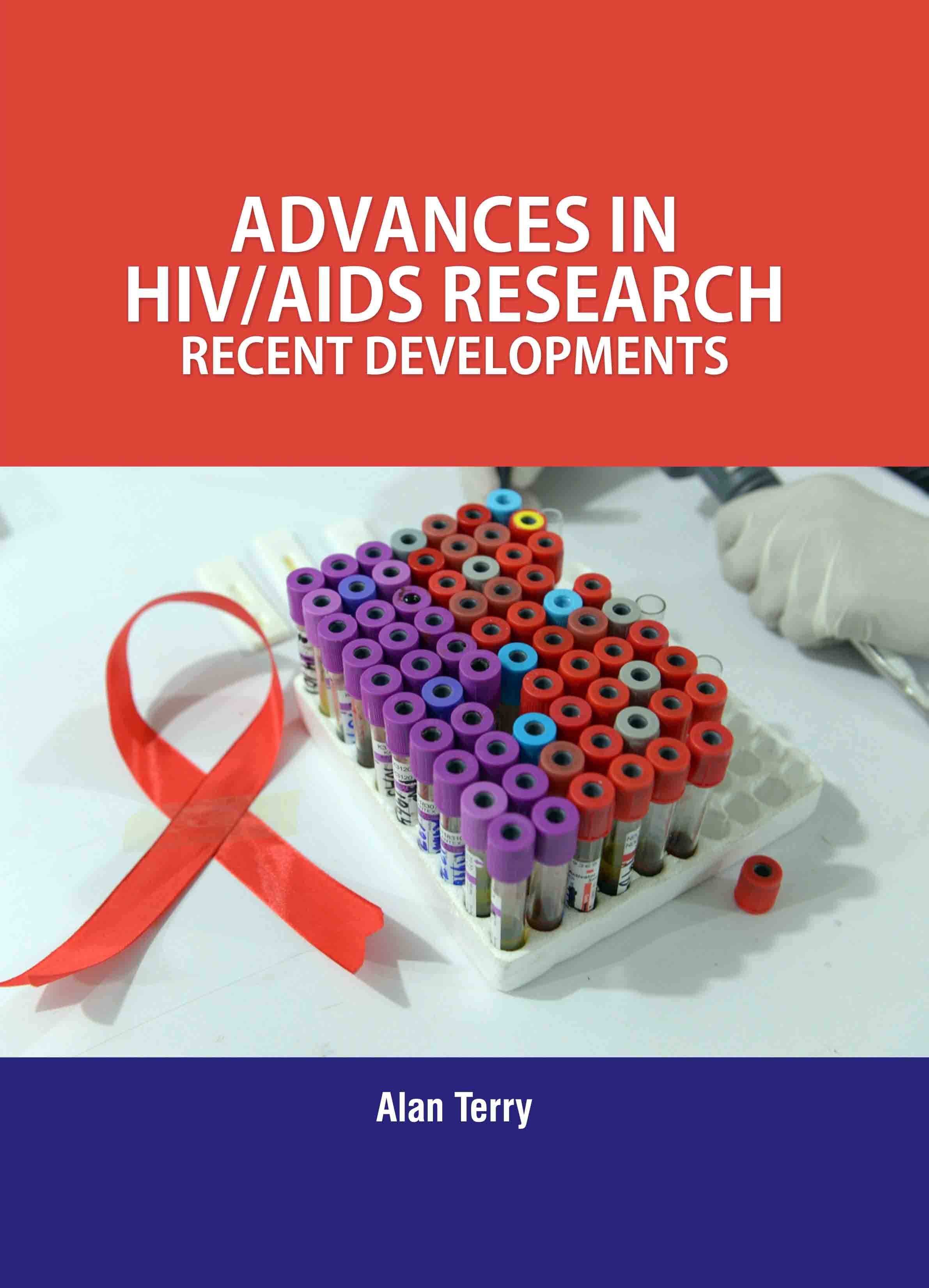 Advances in Hiv/Aids Research: Recent Developments