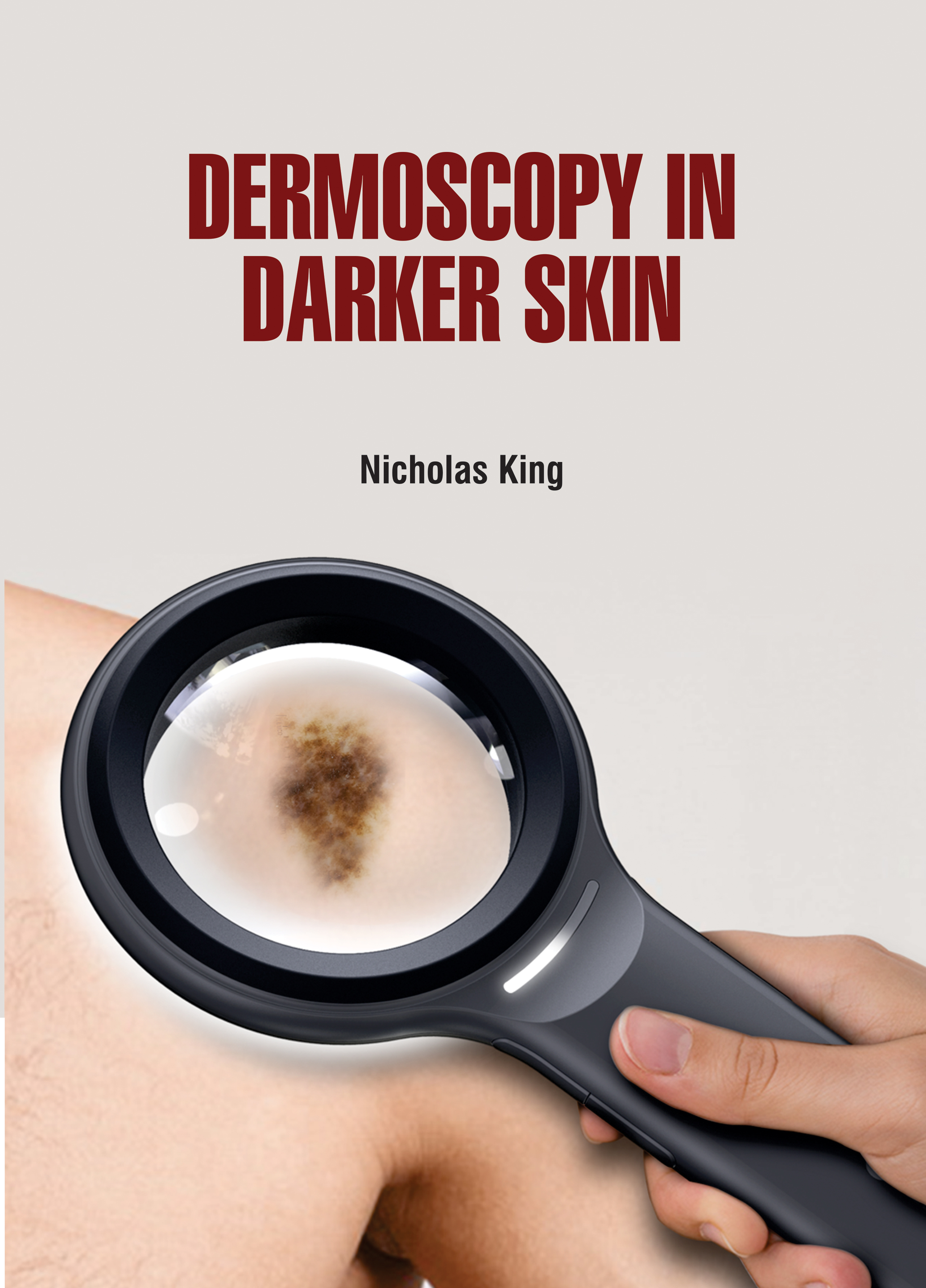 Dermoscopy in Darker Skin