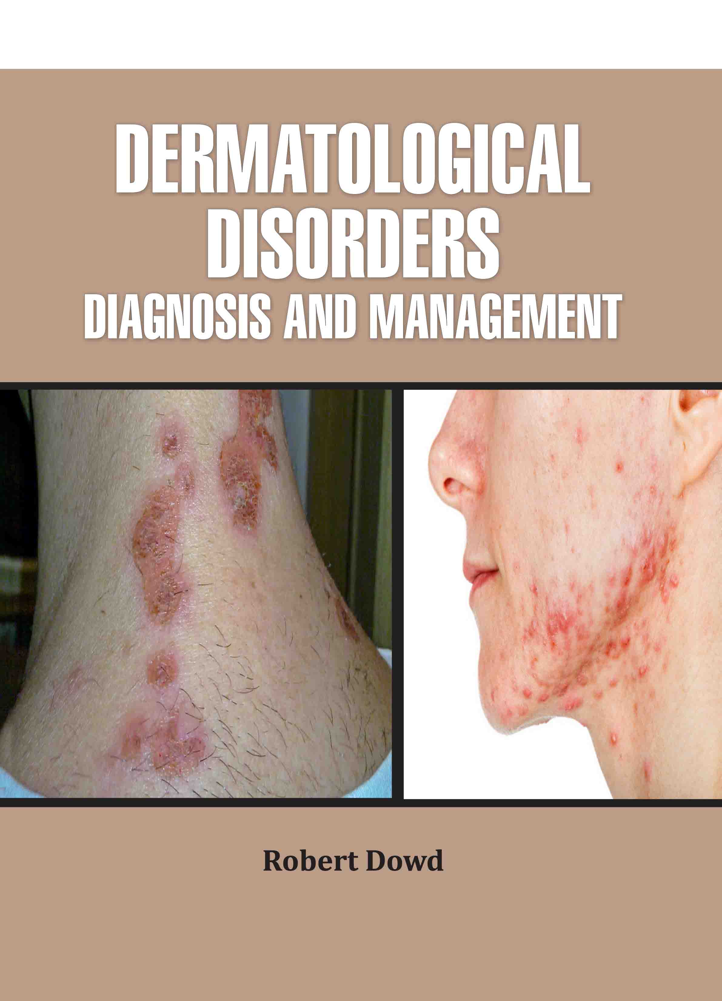 Dermatological Disorders: Diagnosis and Management