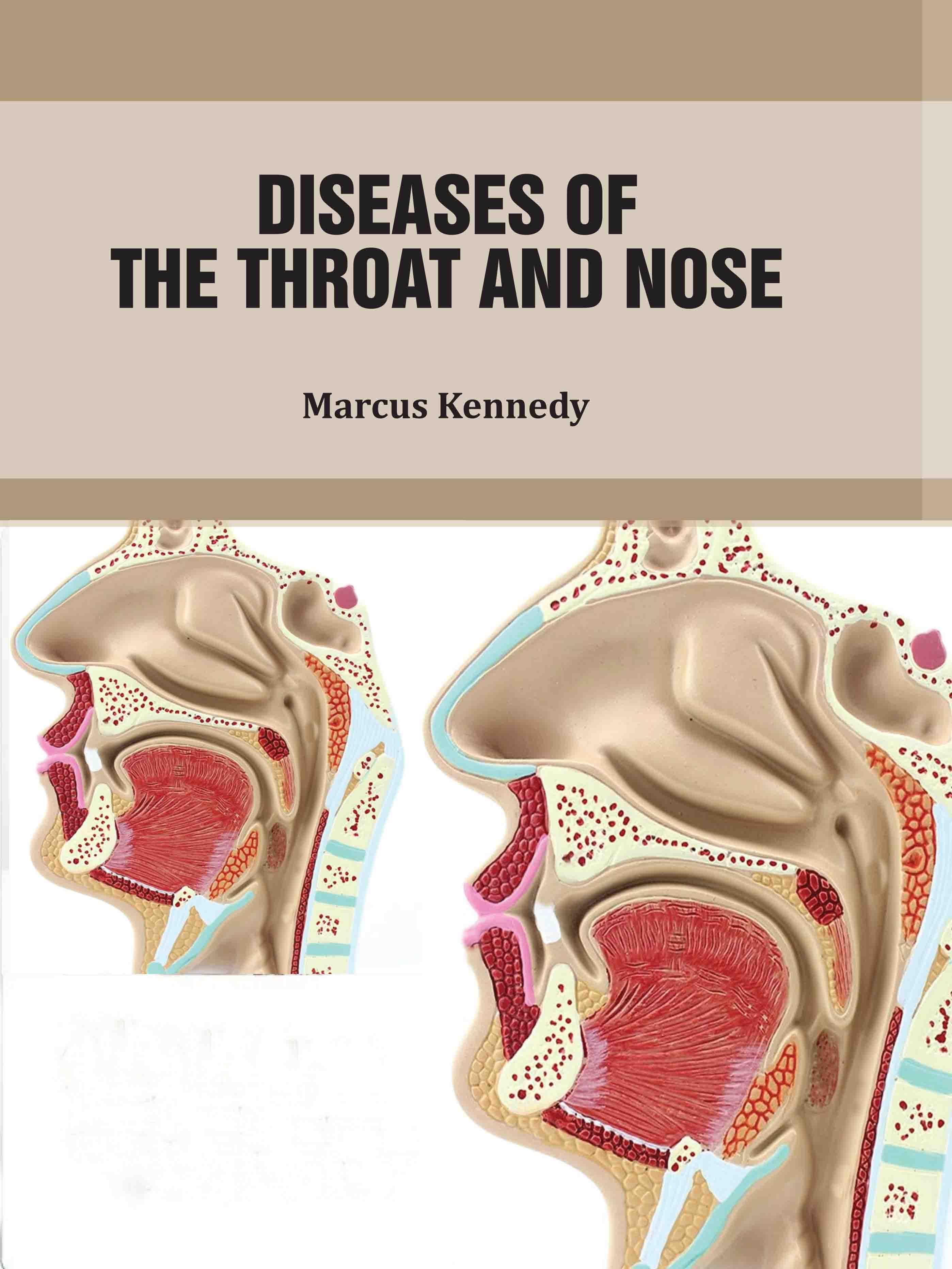 Diseases of The Throat and Nose