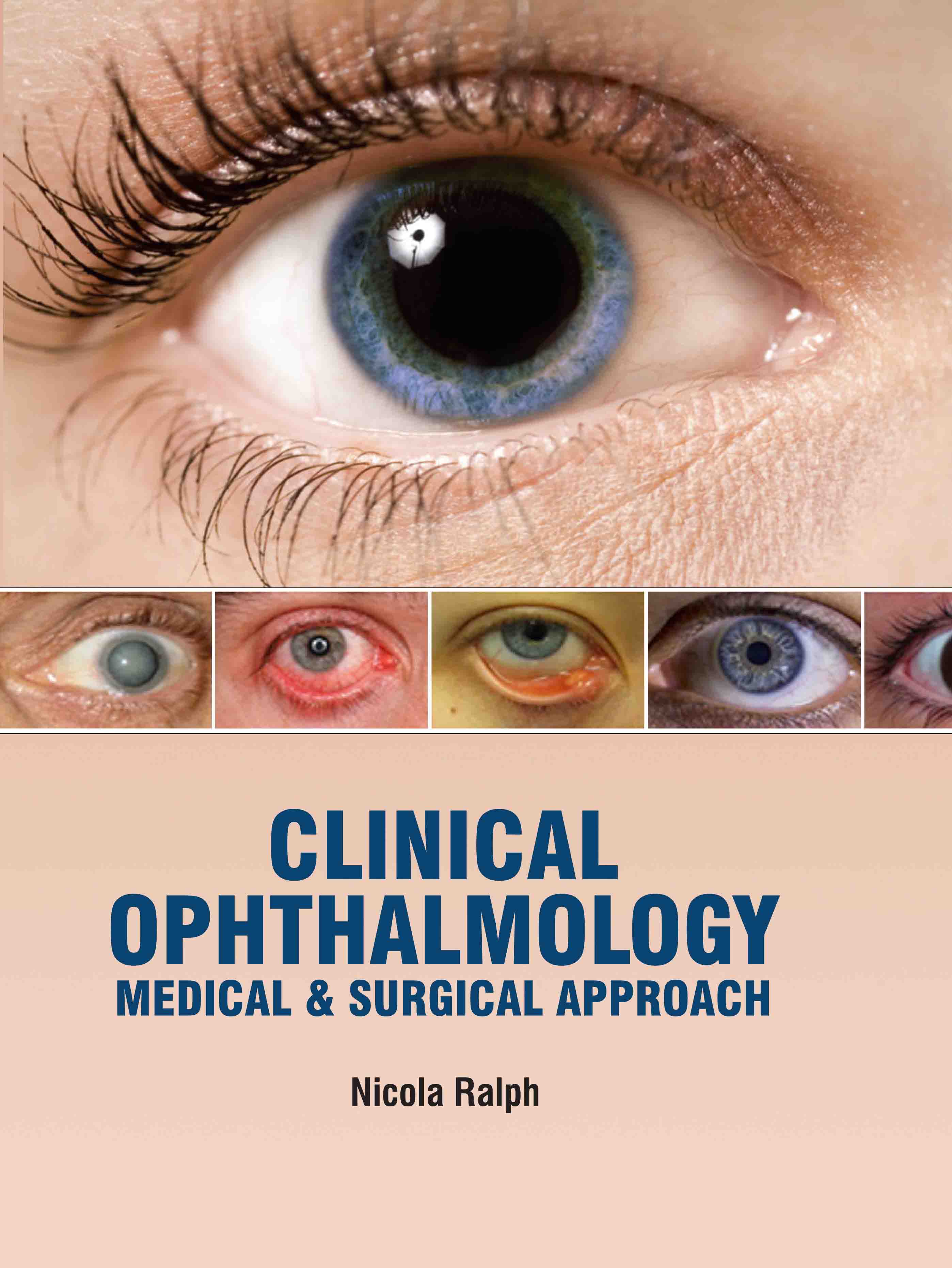 Clinical Ophthalmology: Medical & Surgical Approach